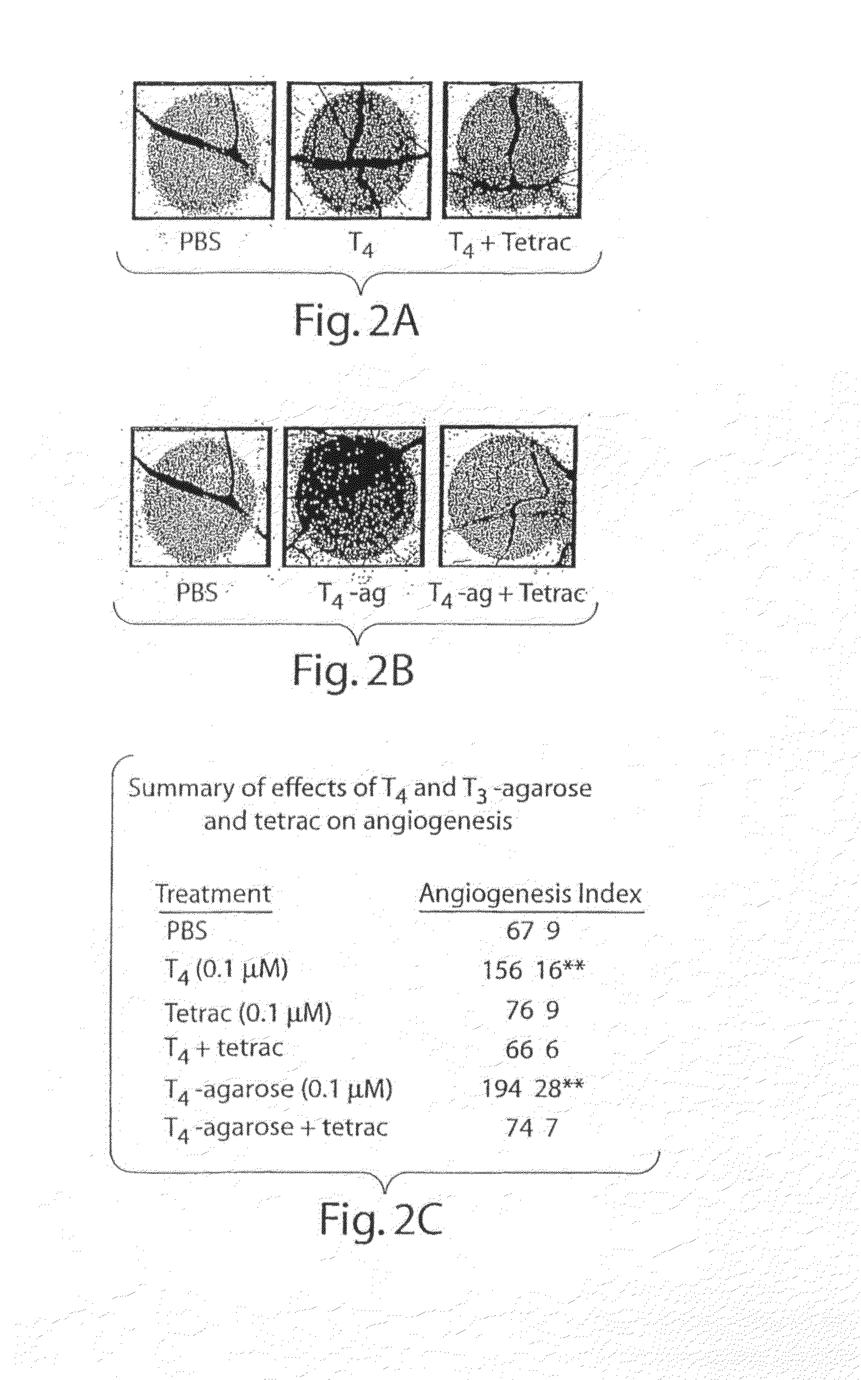 Thyroid Hormone Analogs and Methods of Use