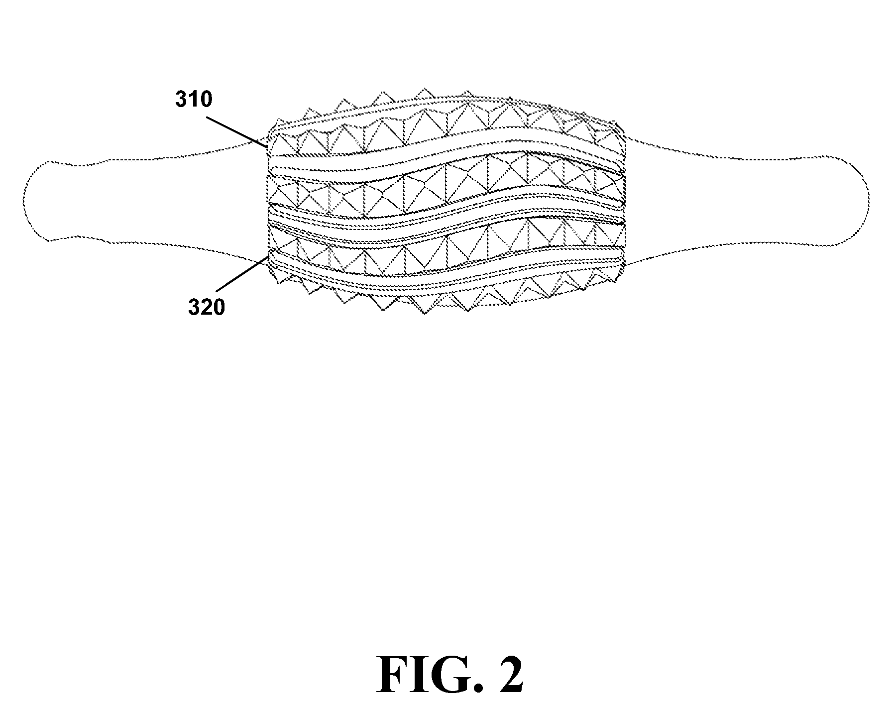 Tenderizing device