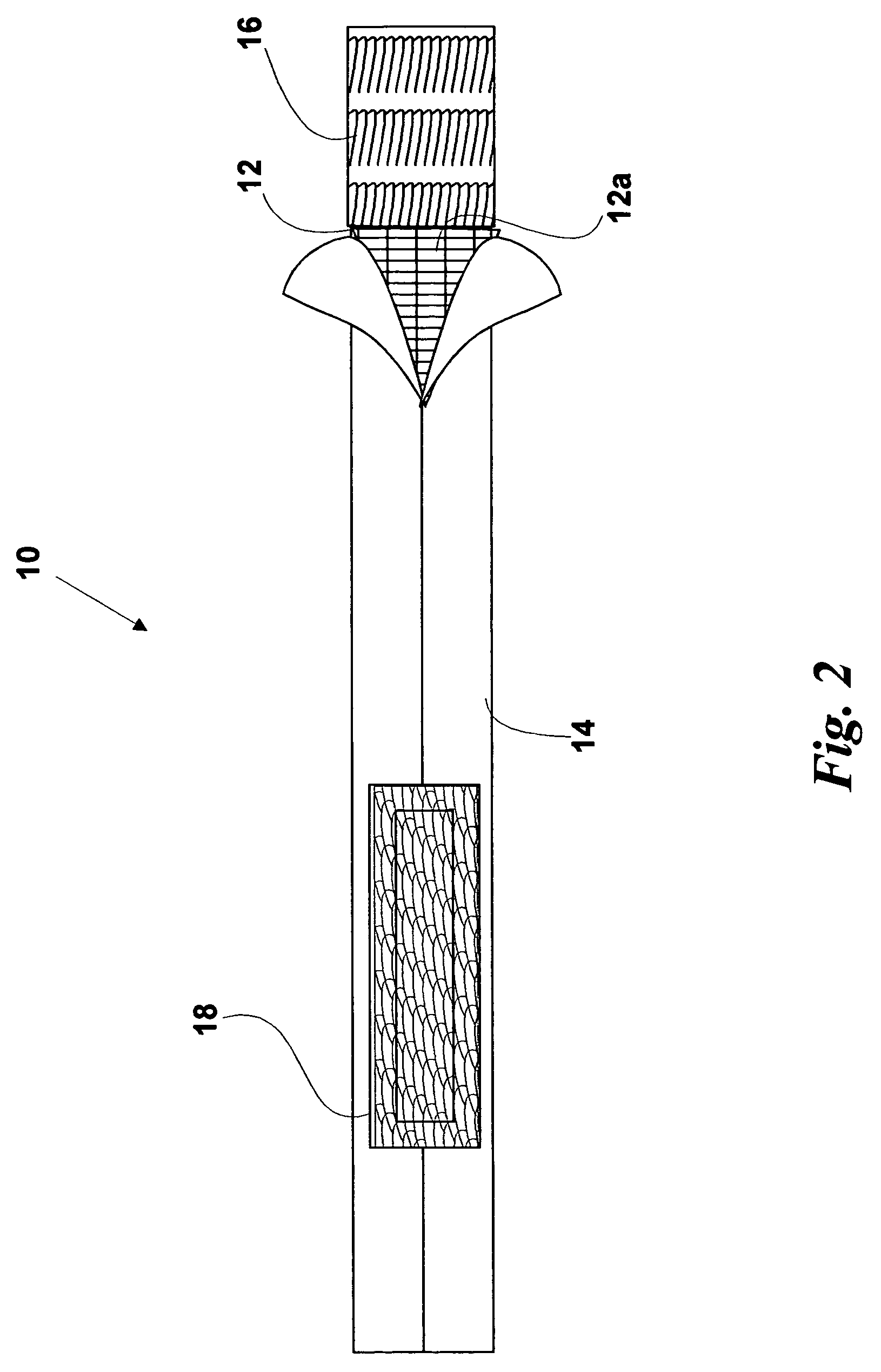 Headache relief band