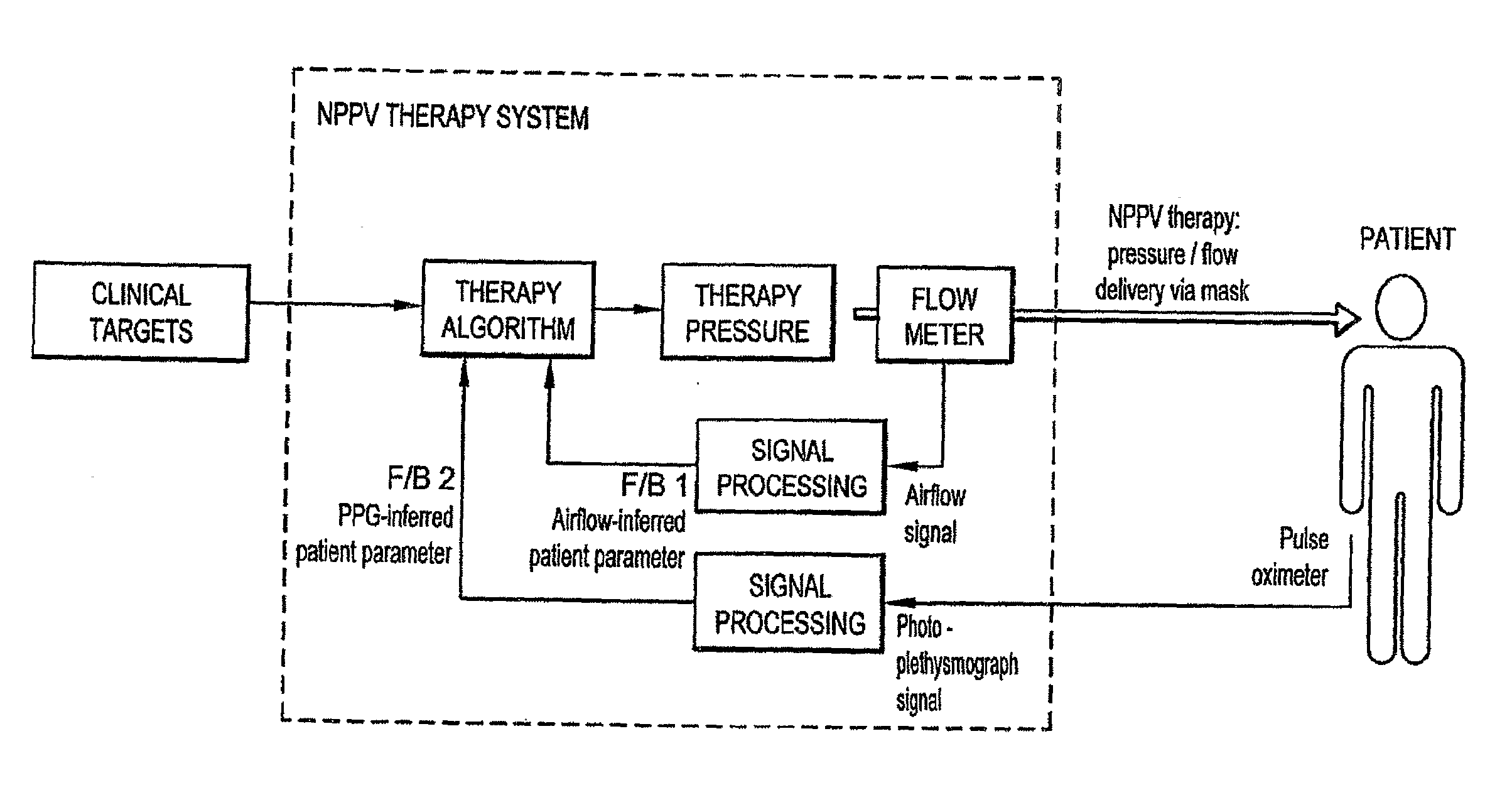 Systems, Methods, and/or Apparatuses for Non-Invasive Monitoring of Respiratory Parameters in Sleep Disordered Breathing