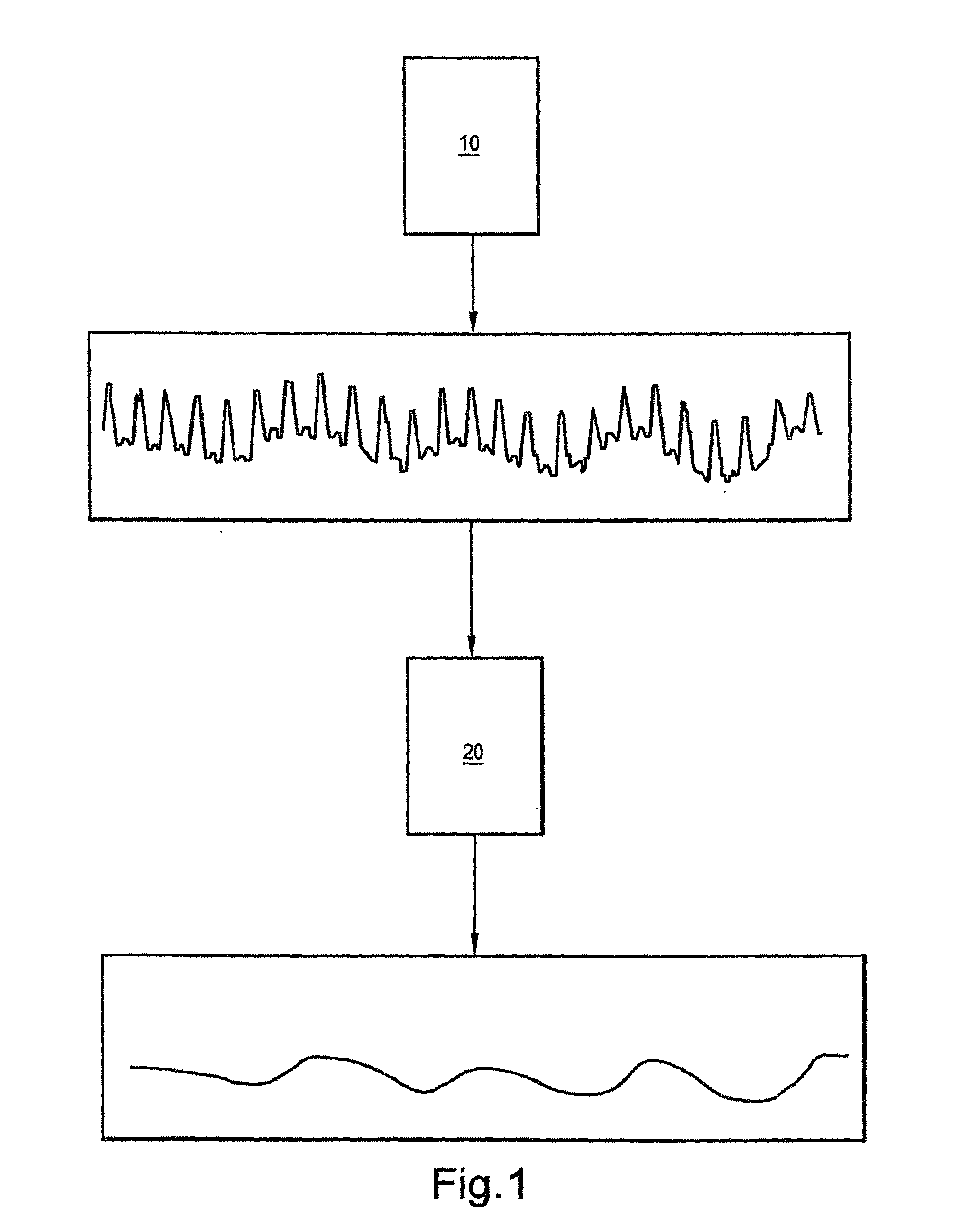 Systems, Methods, and/or Apparatuses for Non-Invasive Monitoring of Respiratory Parameters in Sleep Disordered Breathing