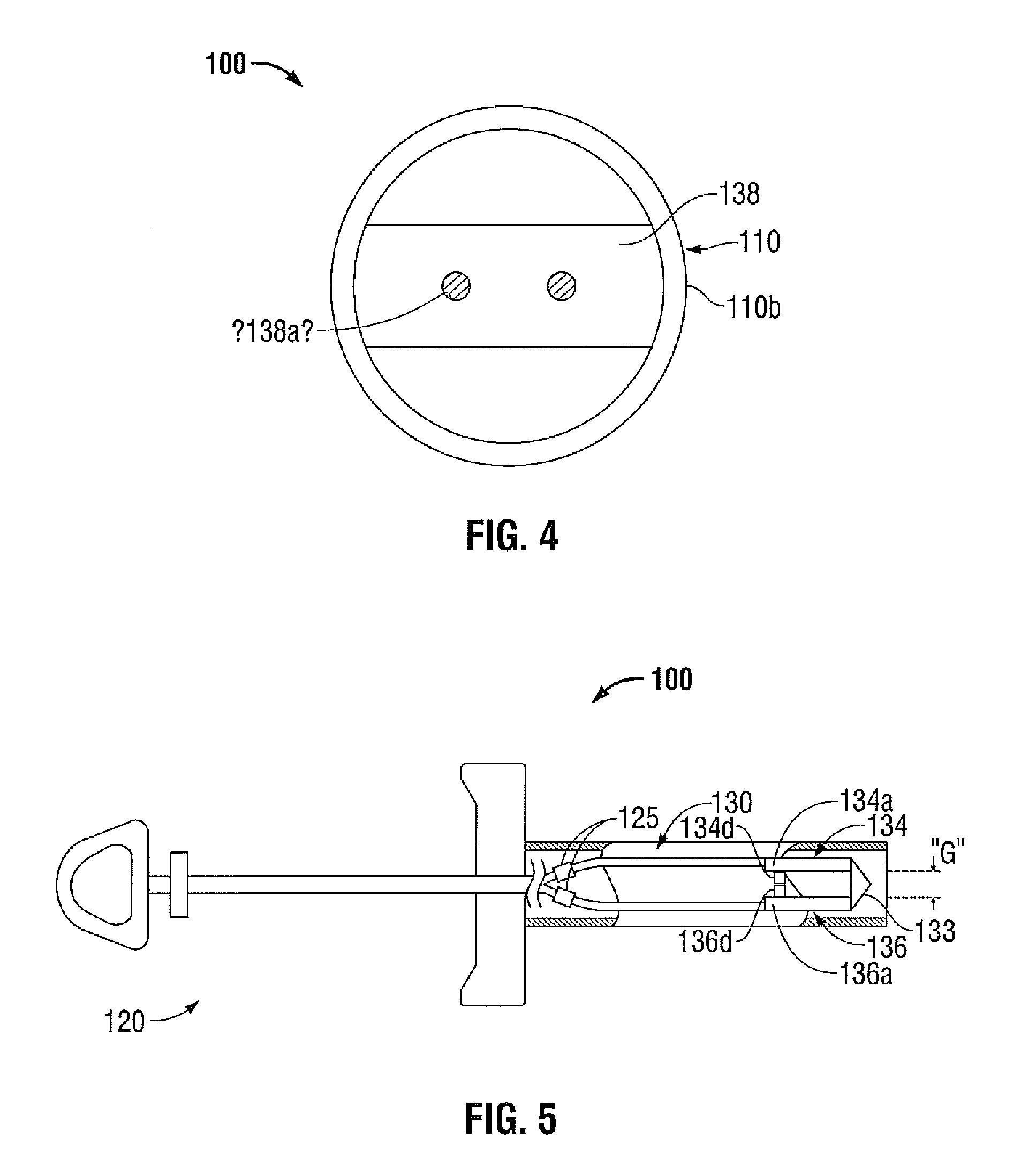 Polyp Removal Device and Method of Use