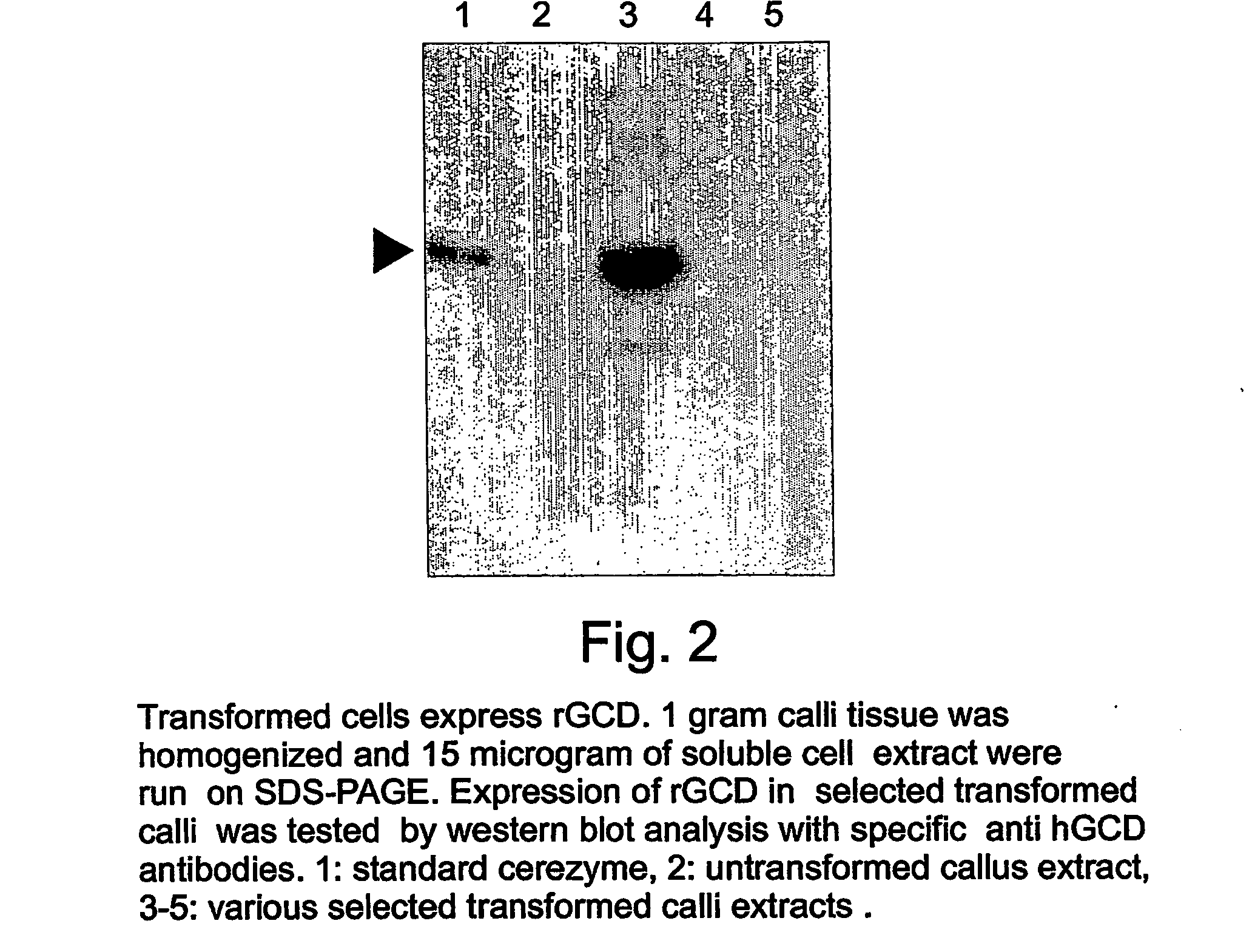 Production of high mannose proteins in plant culture