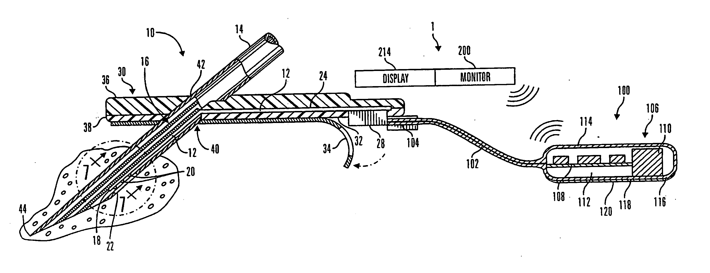 Telemetered characteristic monitor system and method of using the same