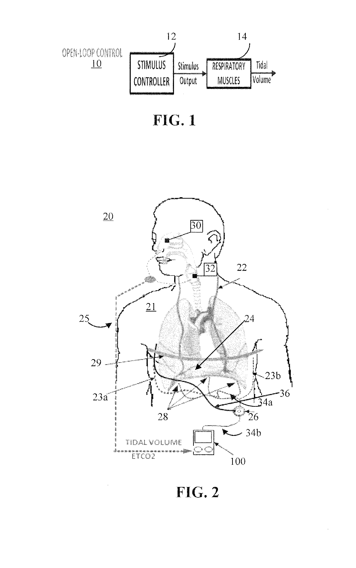 System and method for neuromorphic controlled adaptive pacing of respiratory muscles and nerves