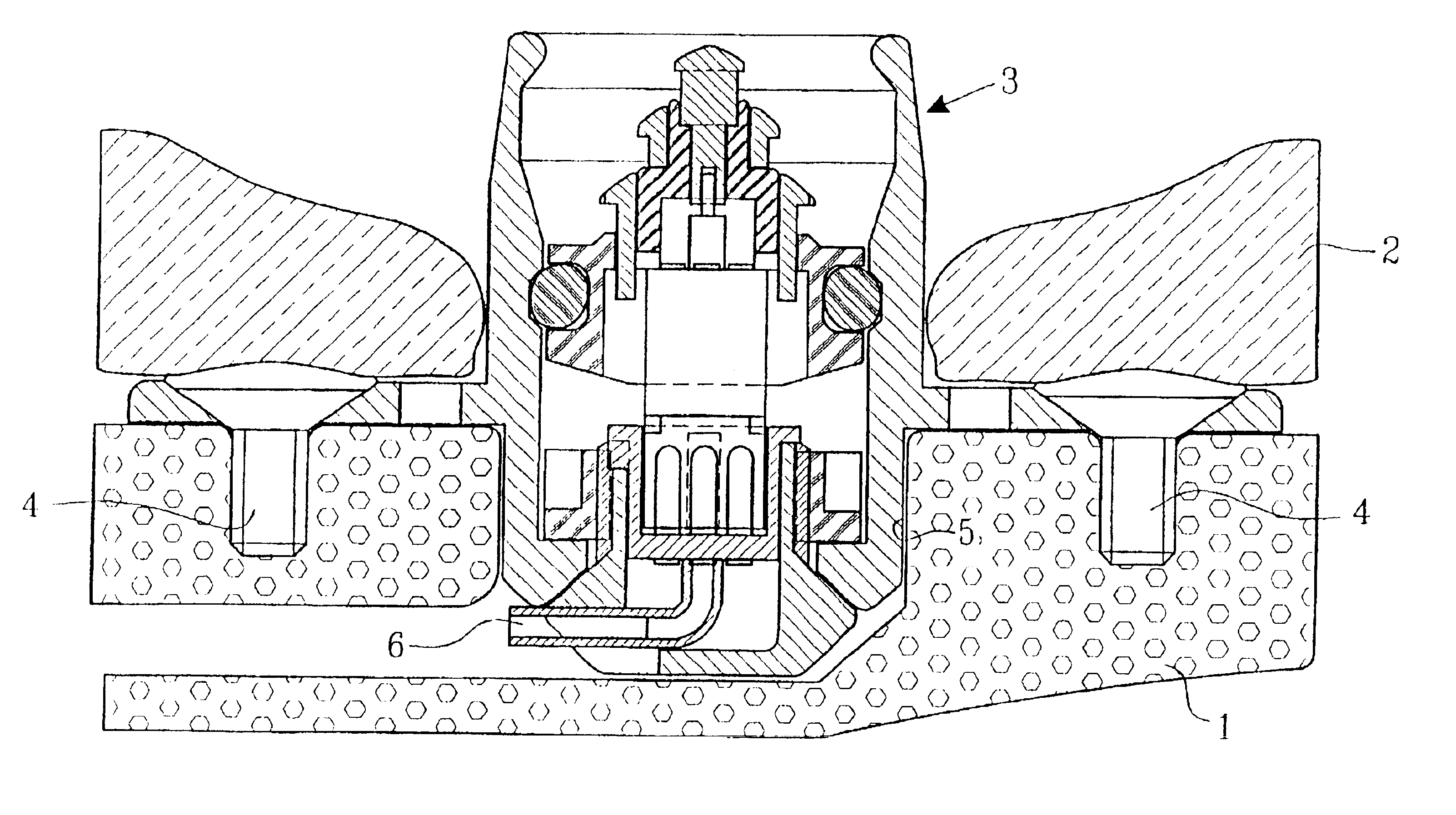 Percutaneous bone anchored transferring device