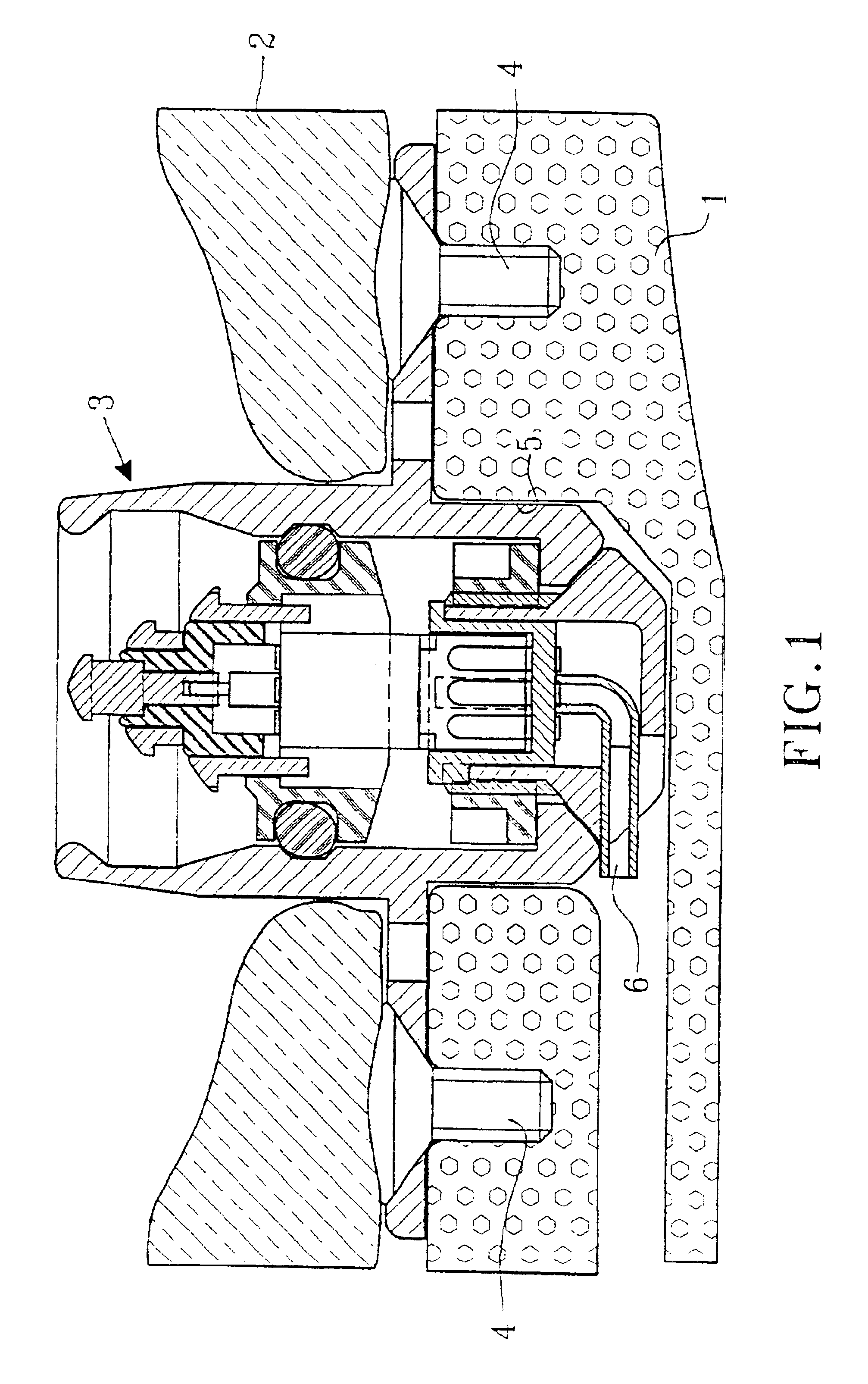 Percutaneous bone anchored transferring device