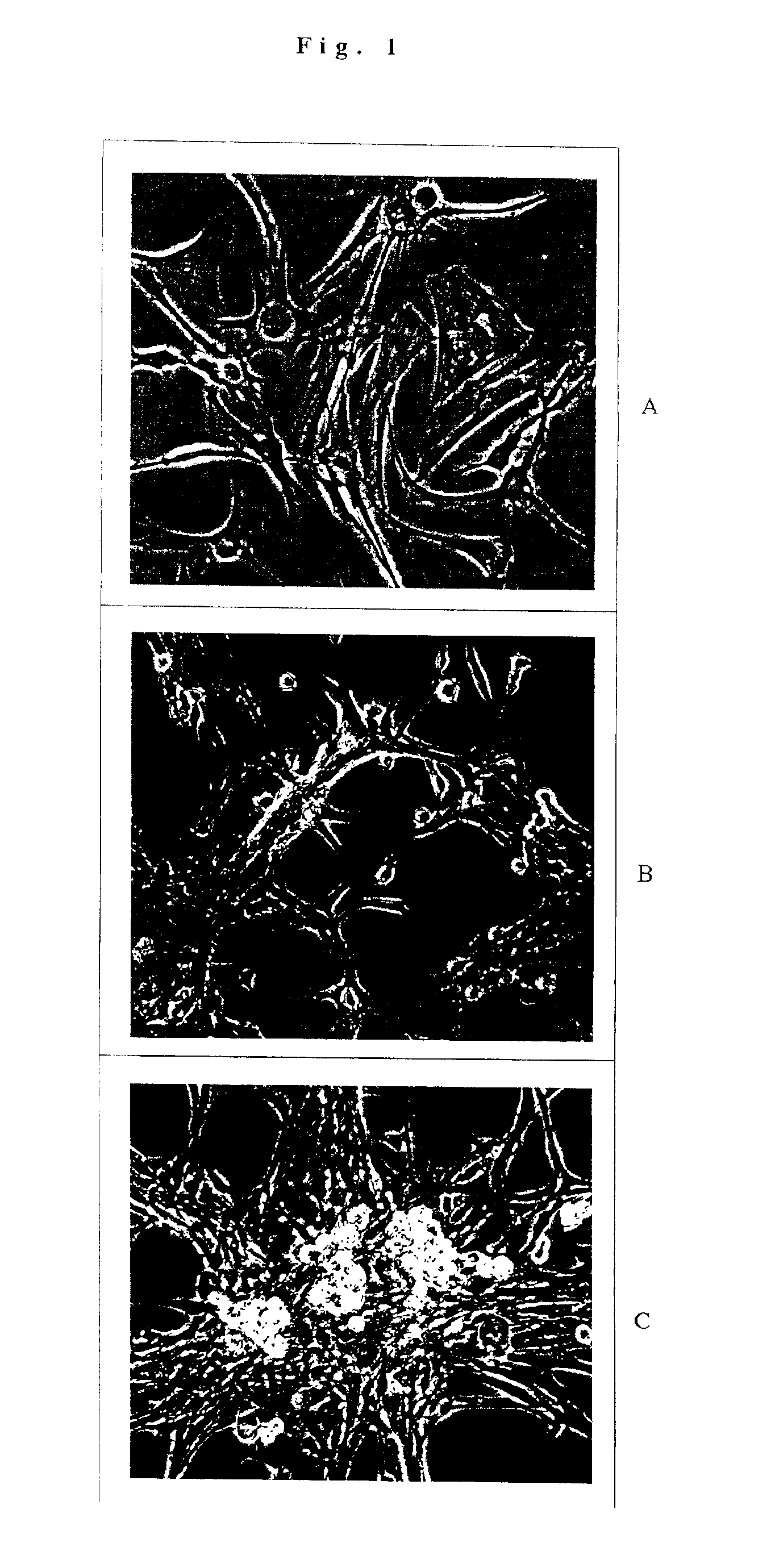 Transdifferentiation of glial cells