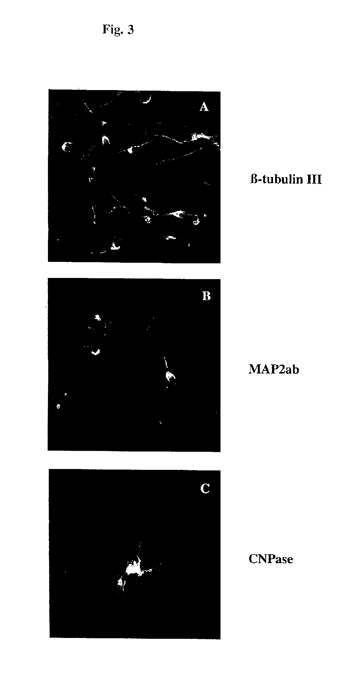 Transdifferentiation of glial cells