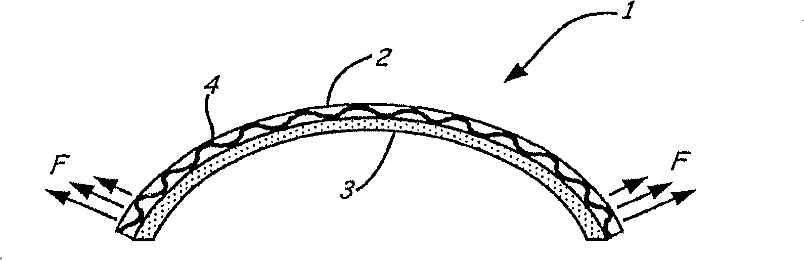 Delayed action spring force element for nasal dilators