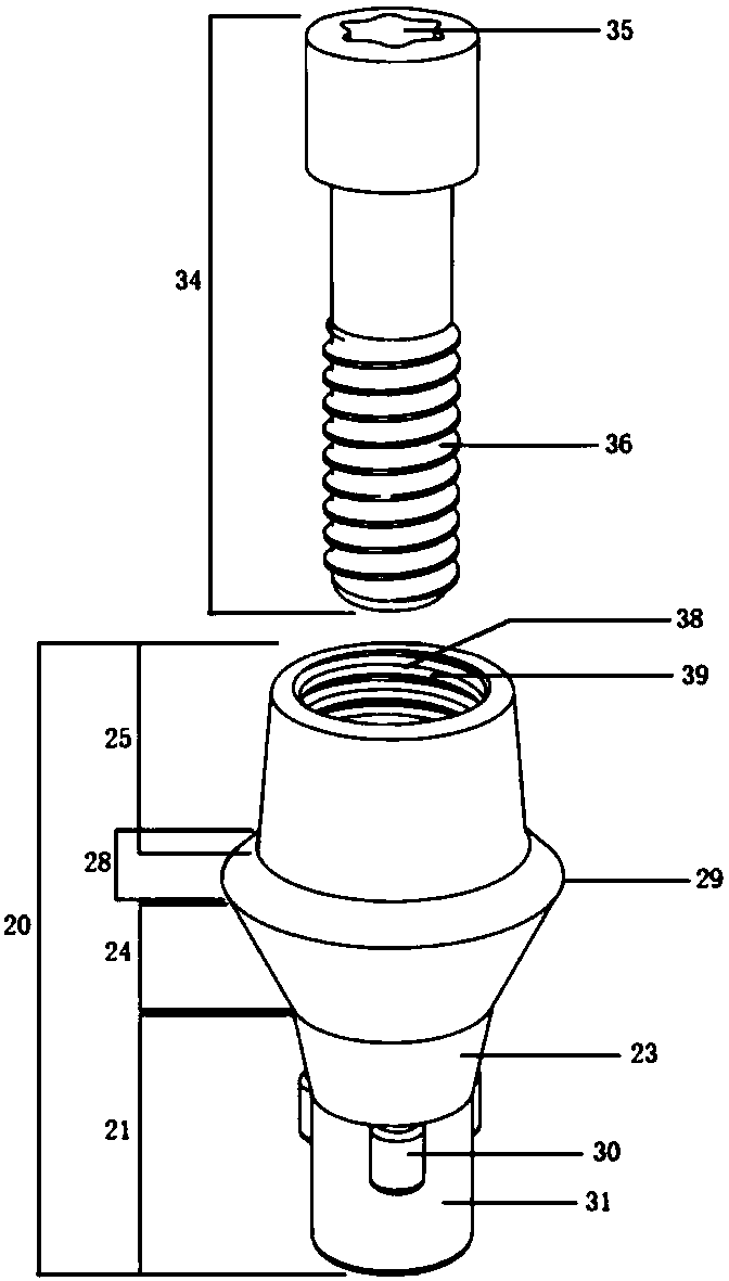 Bridge abutment component for dental implant