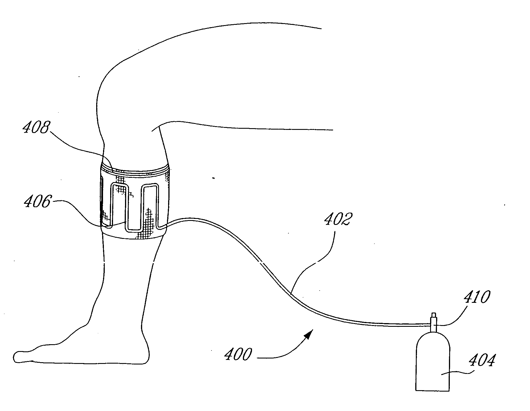 Bandage cooling apparatus and method of using same