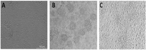 Method, kit and application of reverse differentiation of blood mononuclear cells to produce human blood-derived autologous retinal stem cells