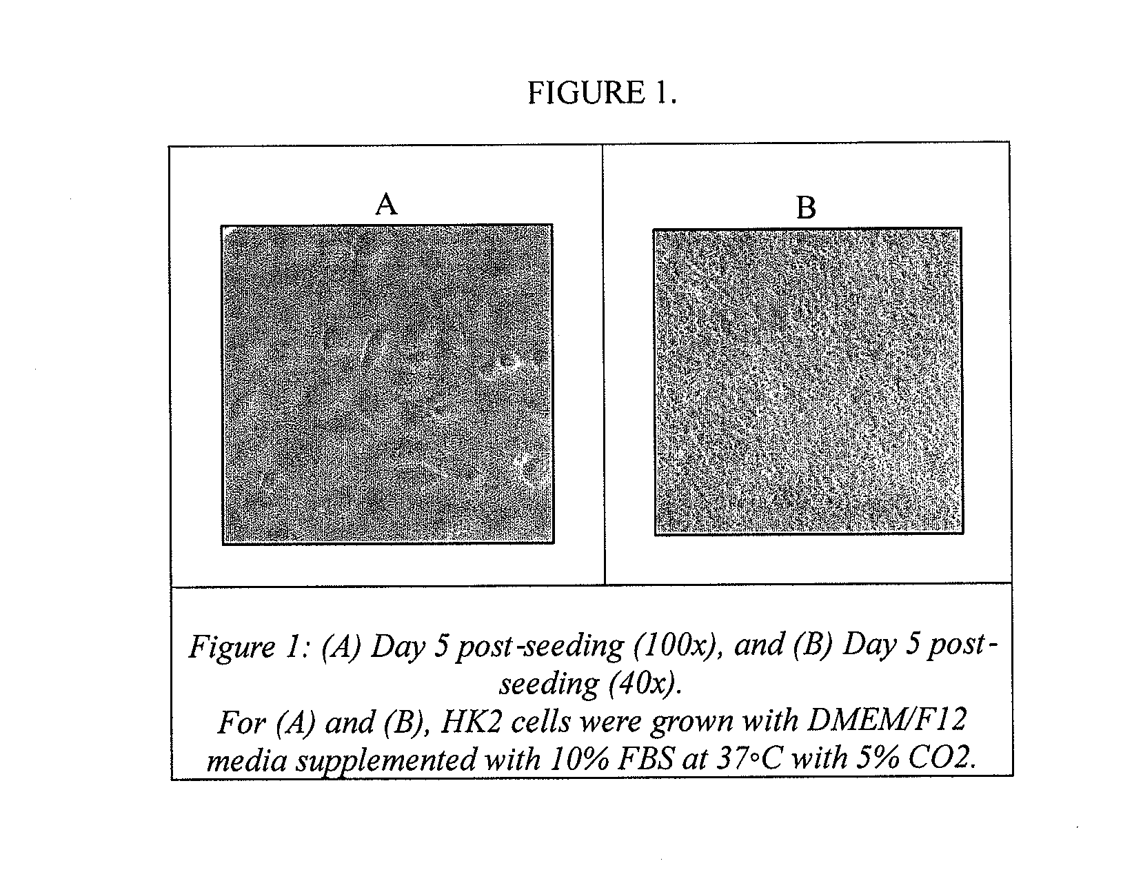 Method of screening pharmaceuticals for drug interactions and nephrotoxicity