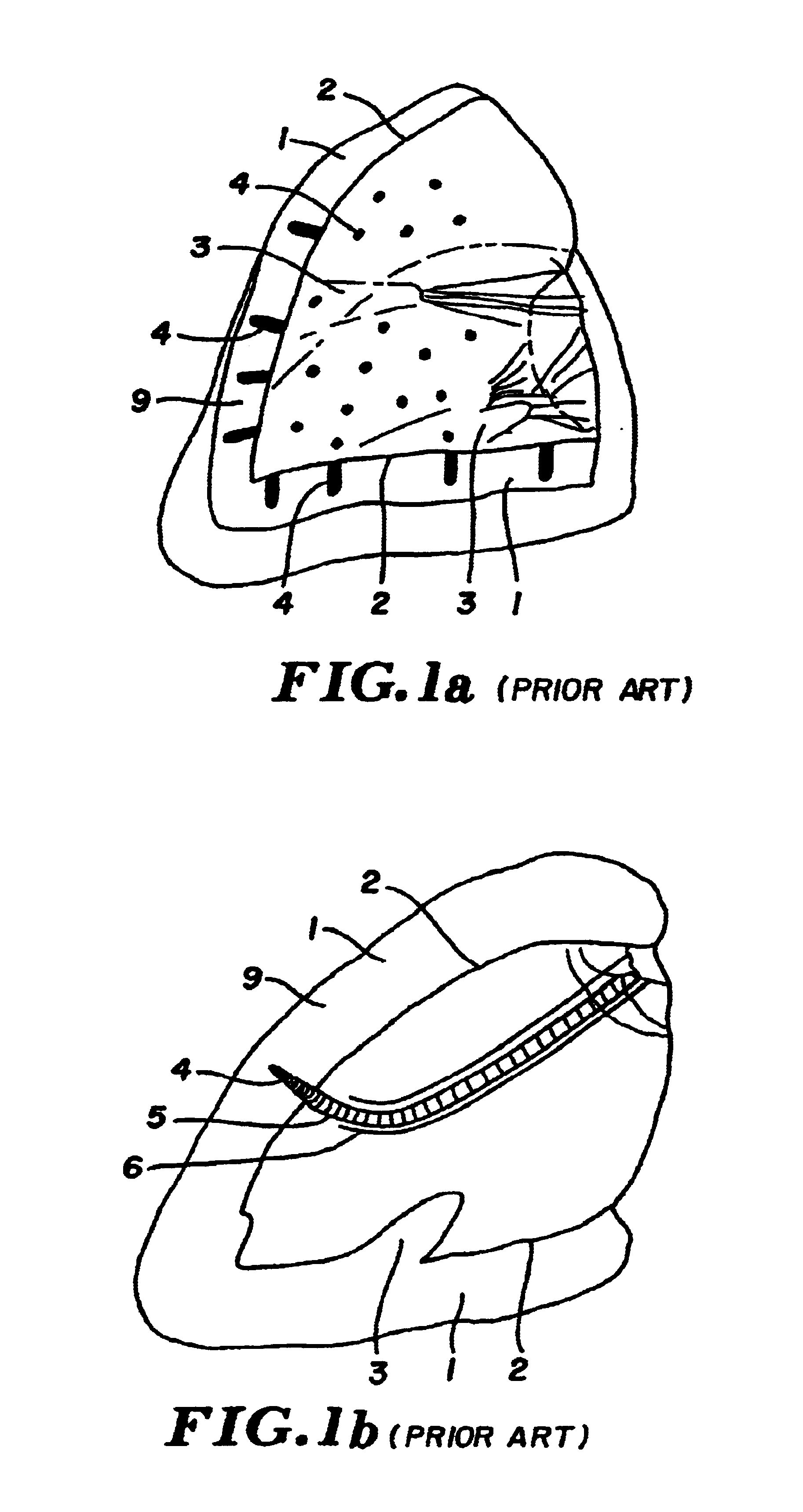 Percutaneous transmyocardial revascularization (PTMR) system