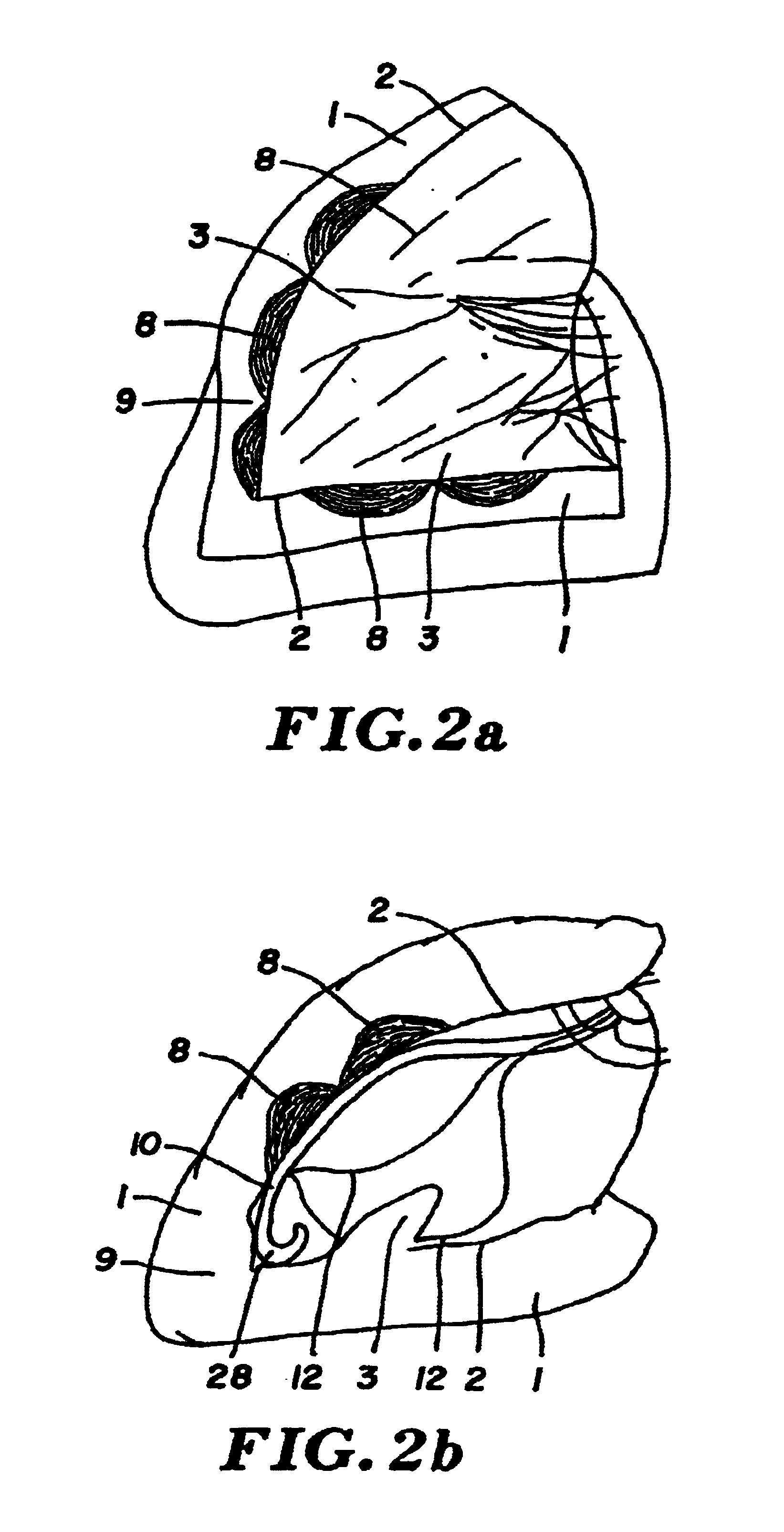 Percutaneous transmyocardial revascularization (PTMR) system