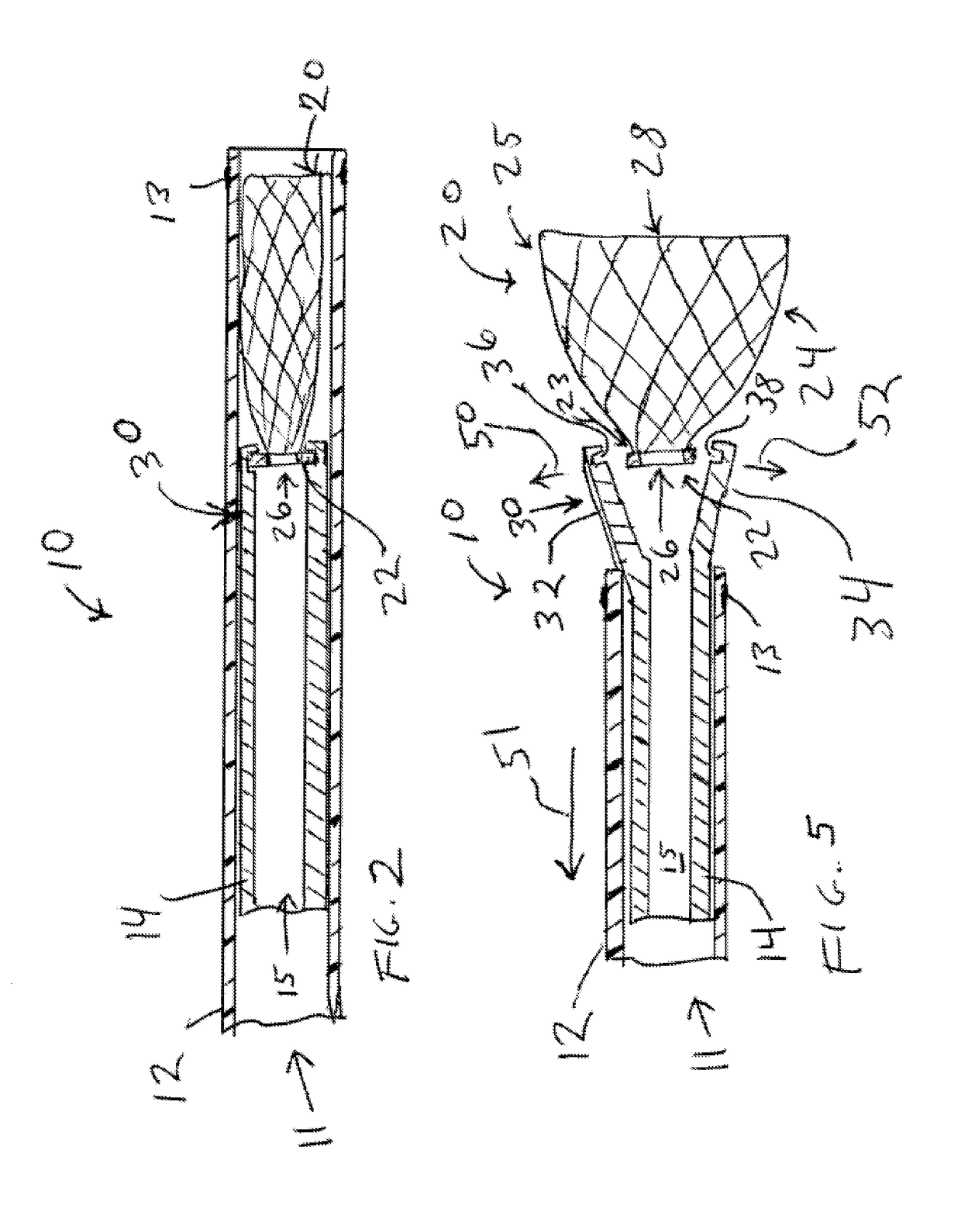 Aneurysm occlusion device