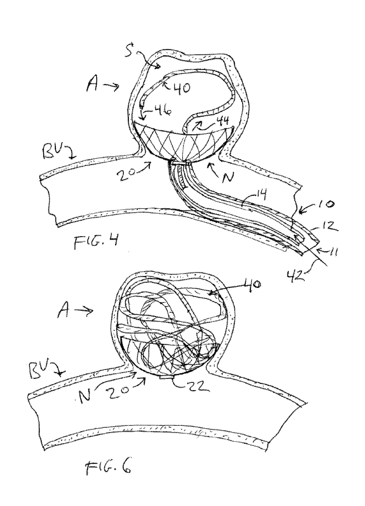 Aneurysm occlusion device