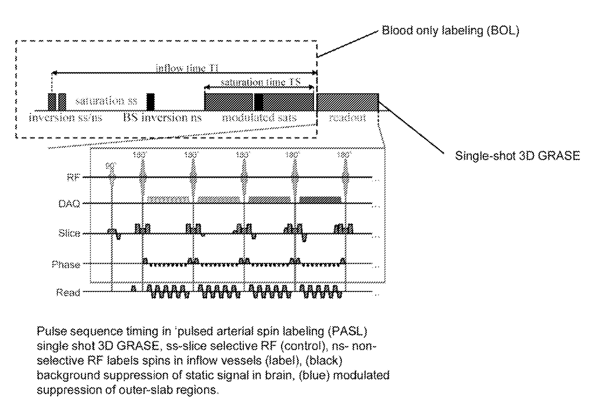 Arterial spin labeled, segmented, interleaved 3D grase MRI