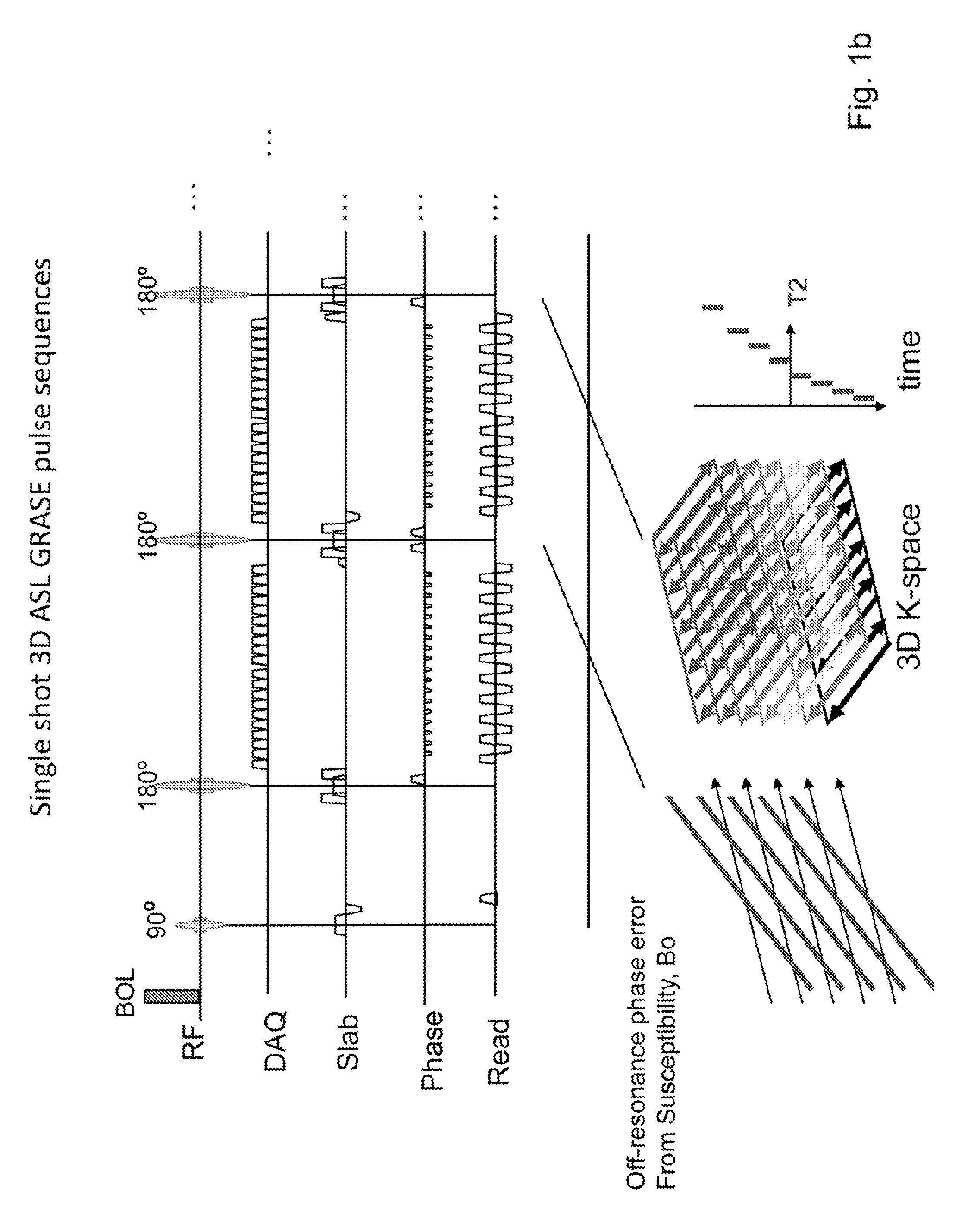 Arterial spin labeled, segmented, interleaved 3D grase MRI