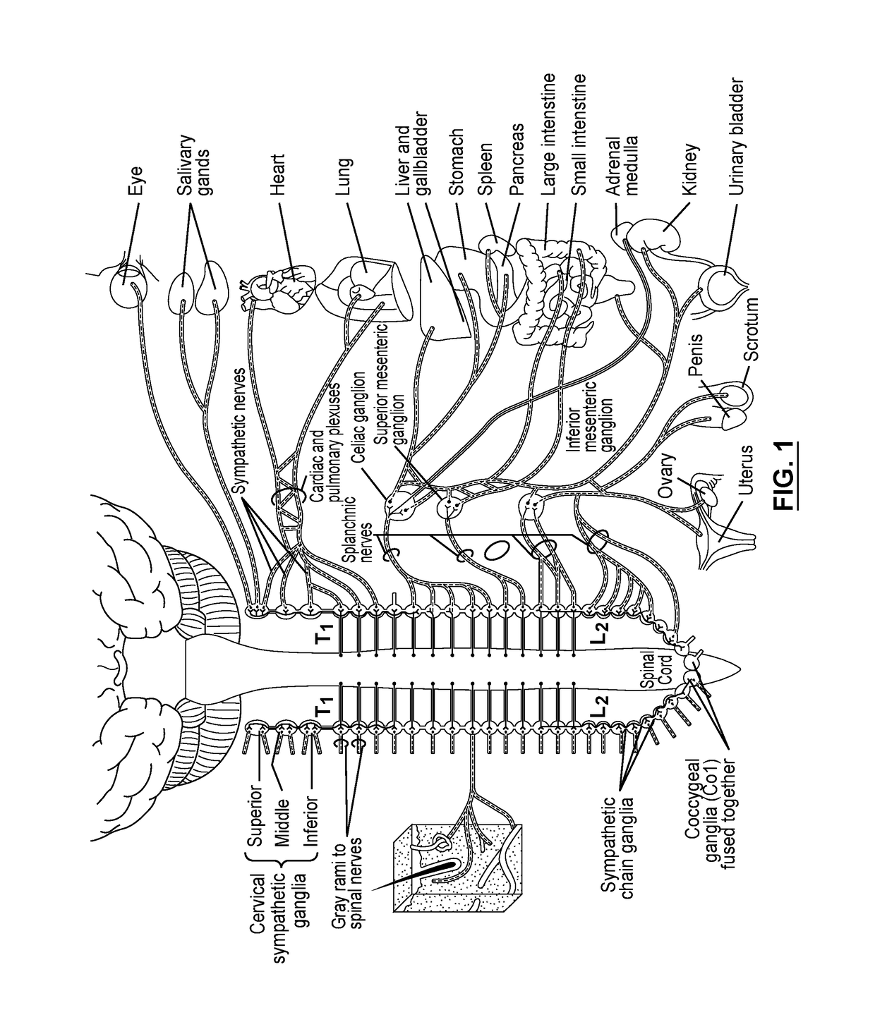 Devices and methods for treatment of heart failure via electrical modulation of a splanchnic nerve