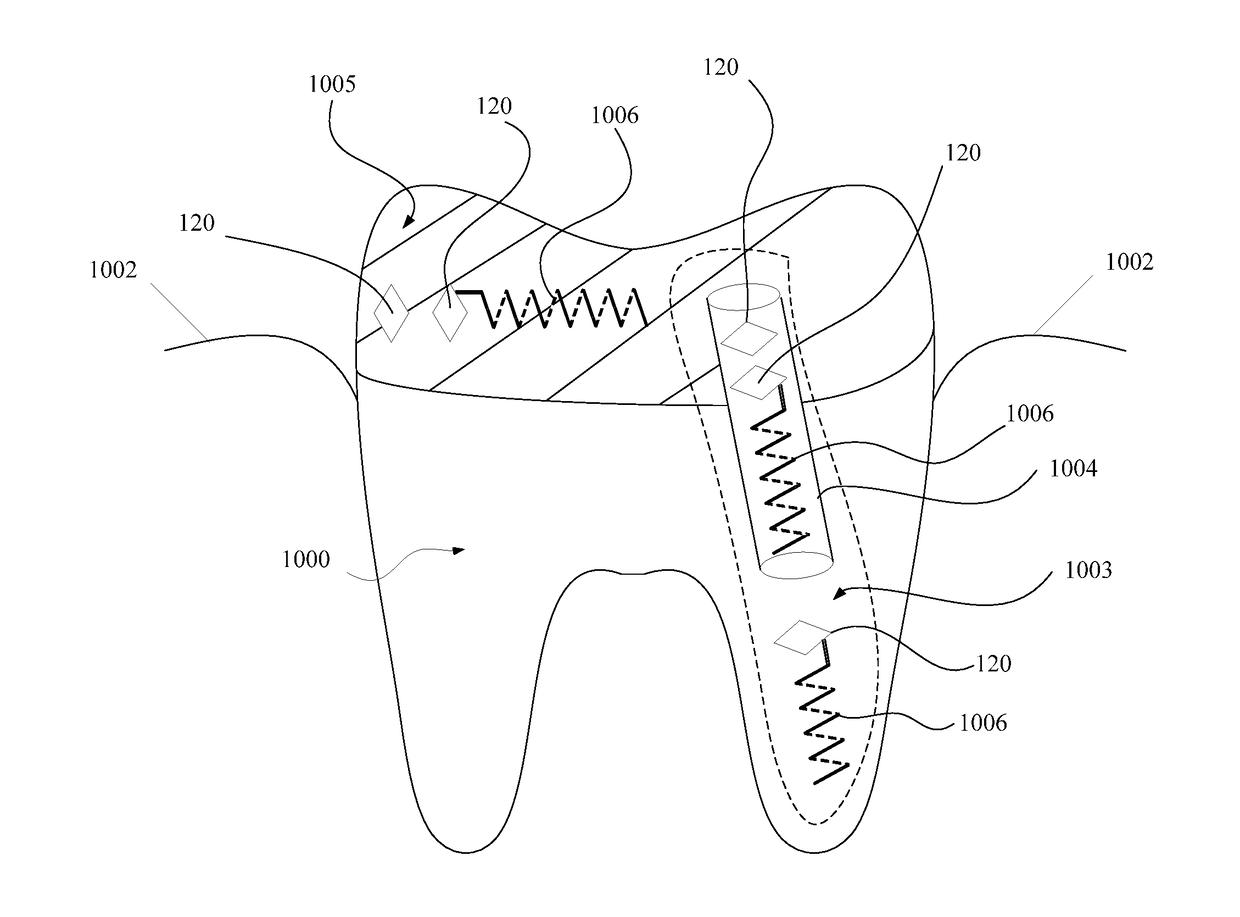 Backscatter device-based dental imaging apparatus