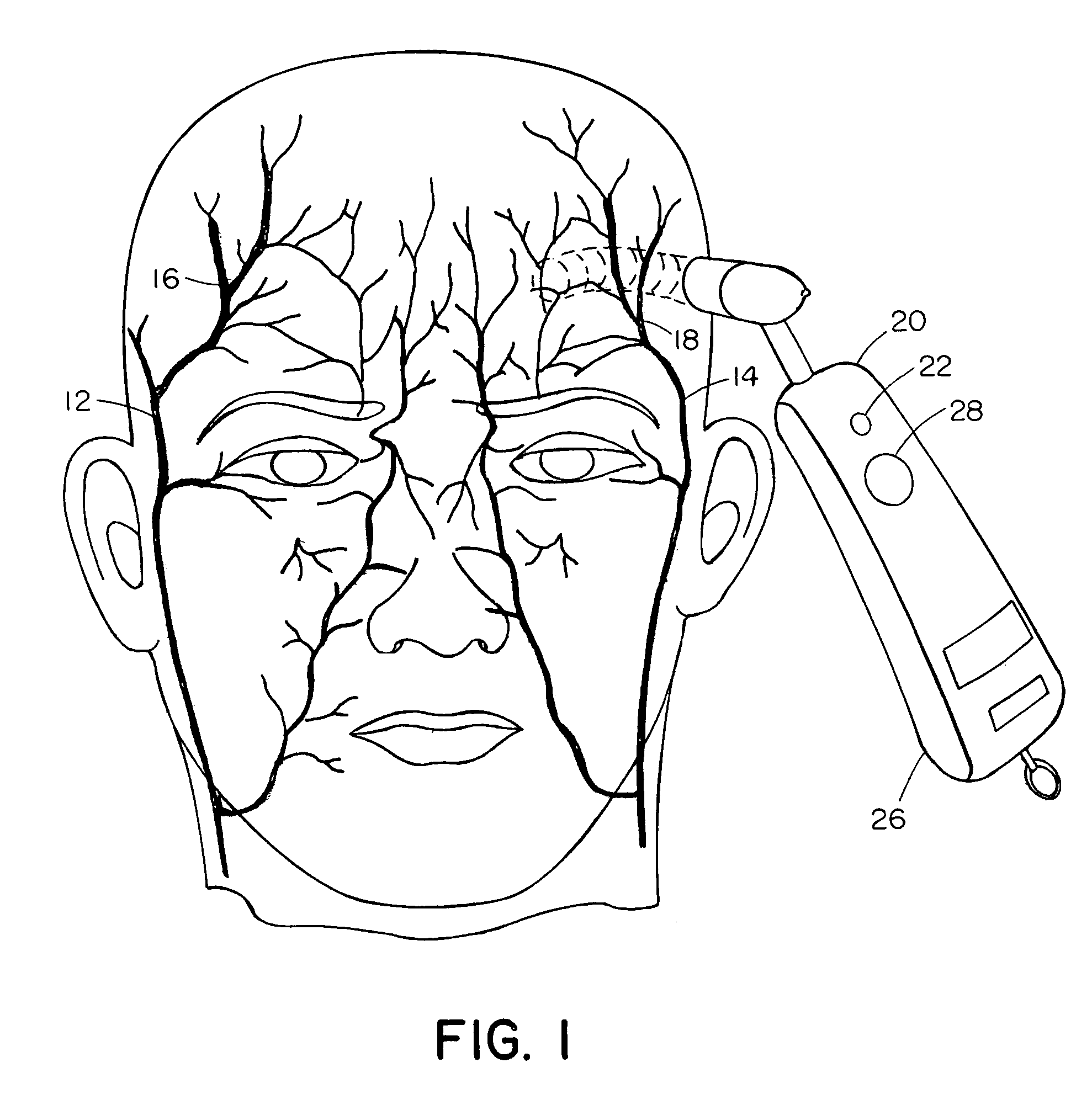 Temporal artery temperature detector