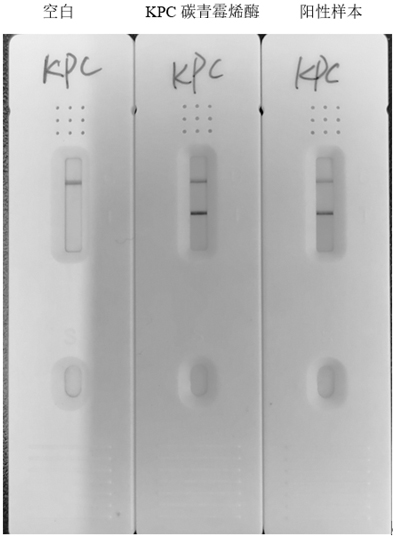 Anti-KPC type carbapenemase hybridoma cell strain, monoclonal antibody and application