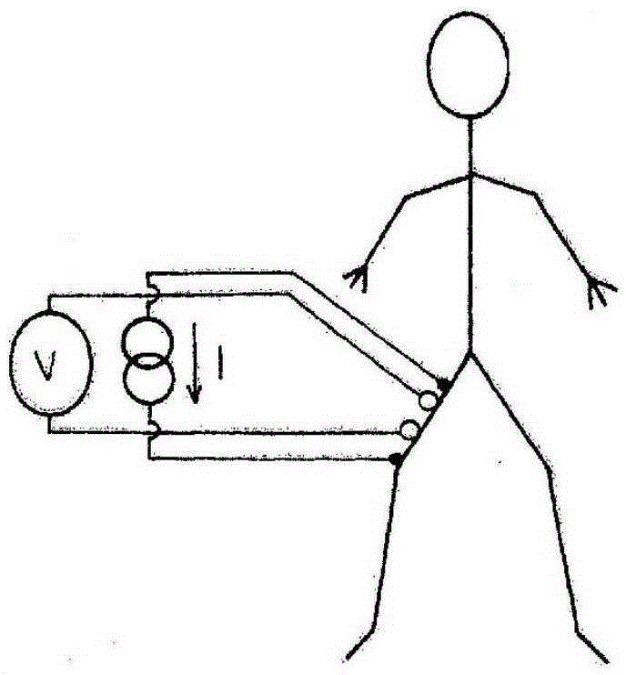 Detection of a leading stroke risk indicator