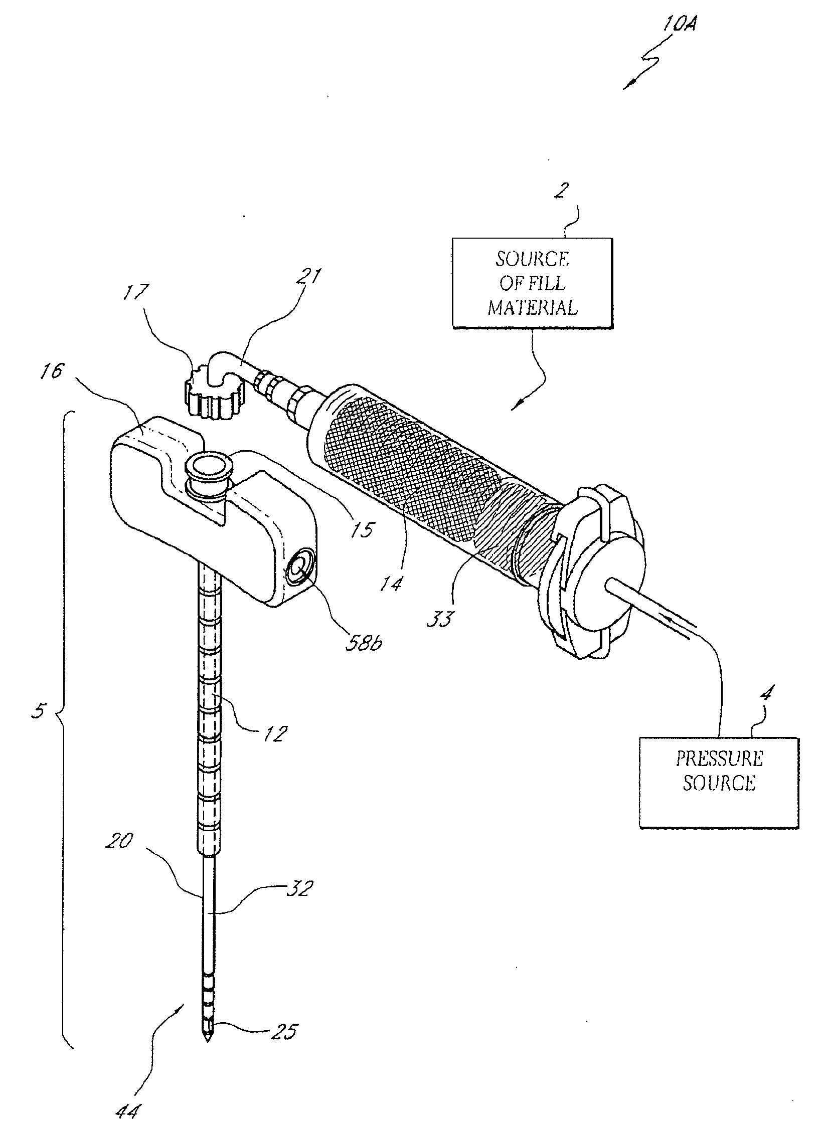 Bone treatment systems and methods