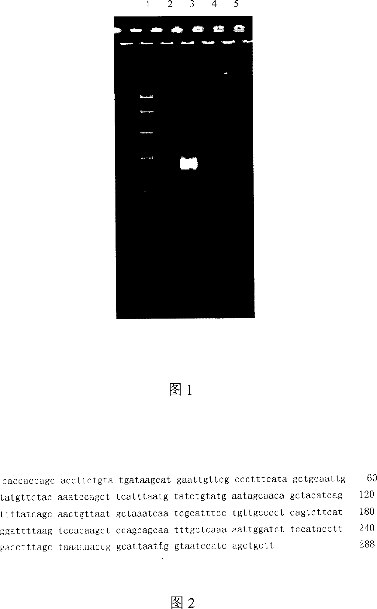 Determination of one section urea degraded mycoplasmos DNA sequence (5) specificity and its application