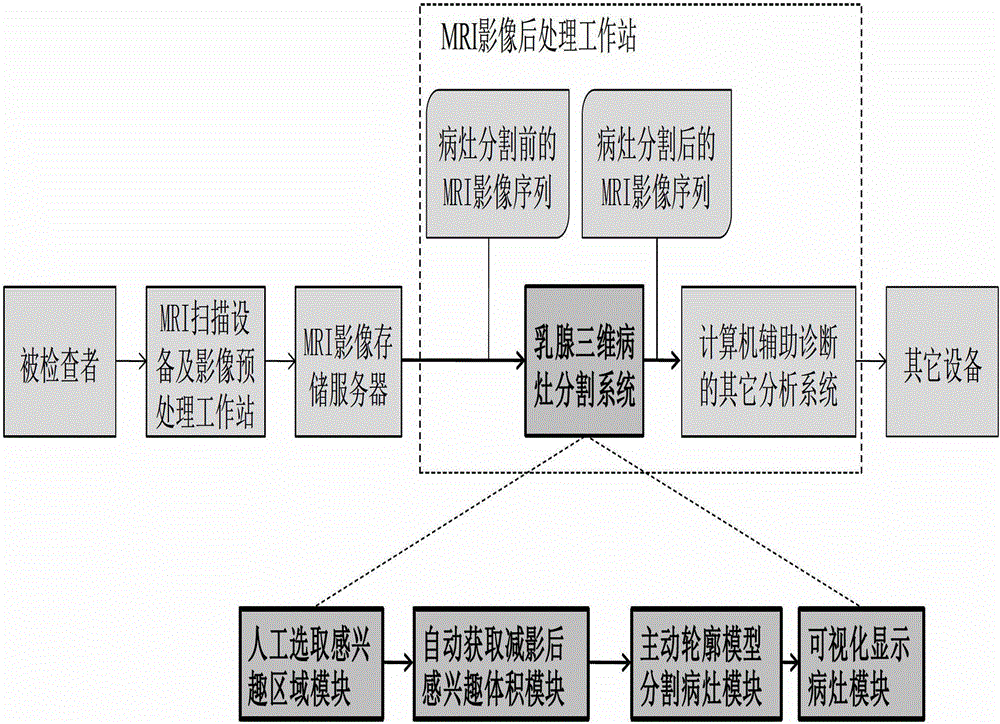 Active contour model based method for segmenting mammary gland DCE-MRI focus