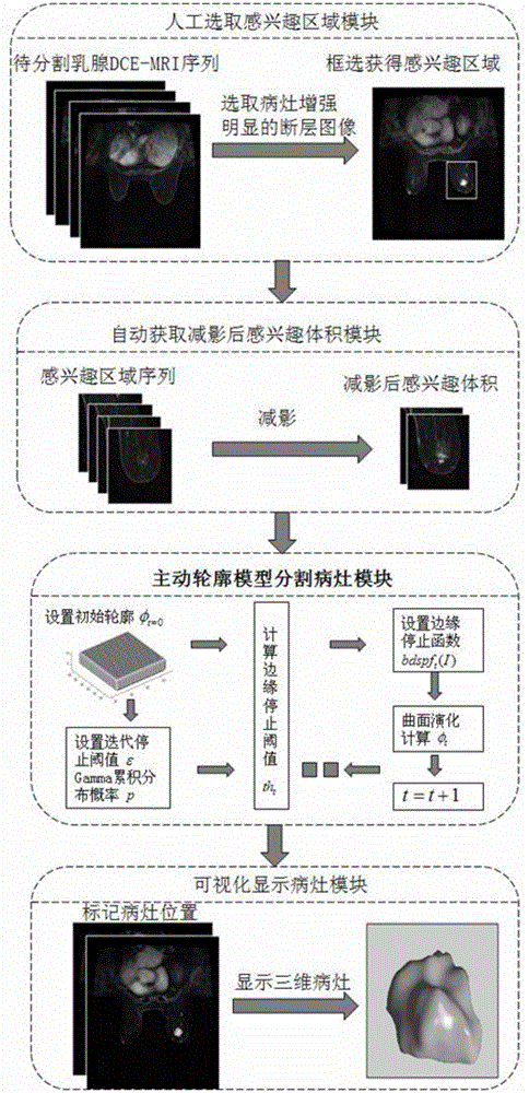 Active contour model based method for segmenting mammary gland DCE-MRI focus