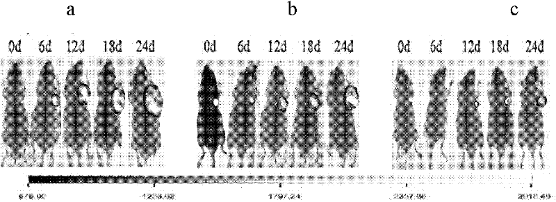 Tumor-targeting albumin nano-lyophilized powder injection preparation and preparation method thereof