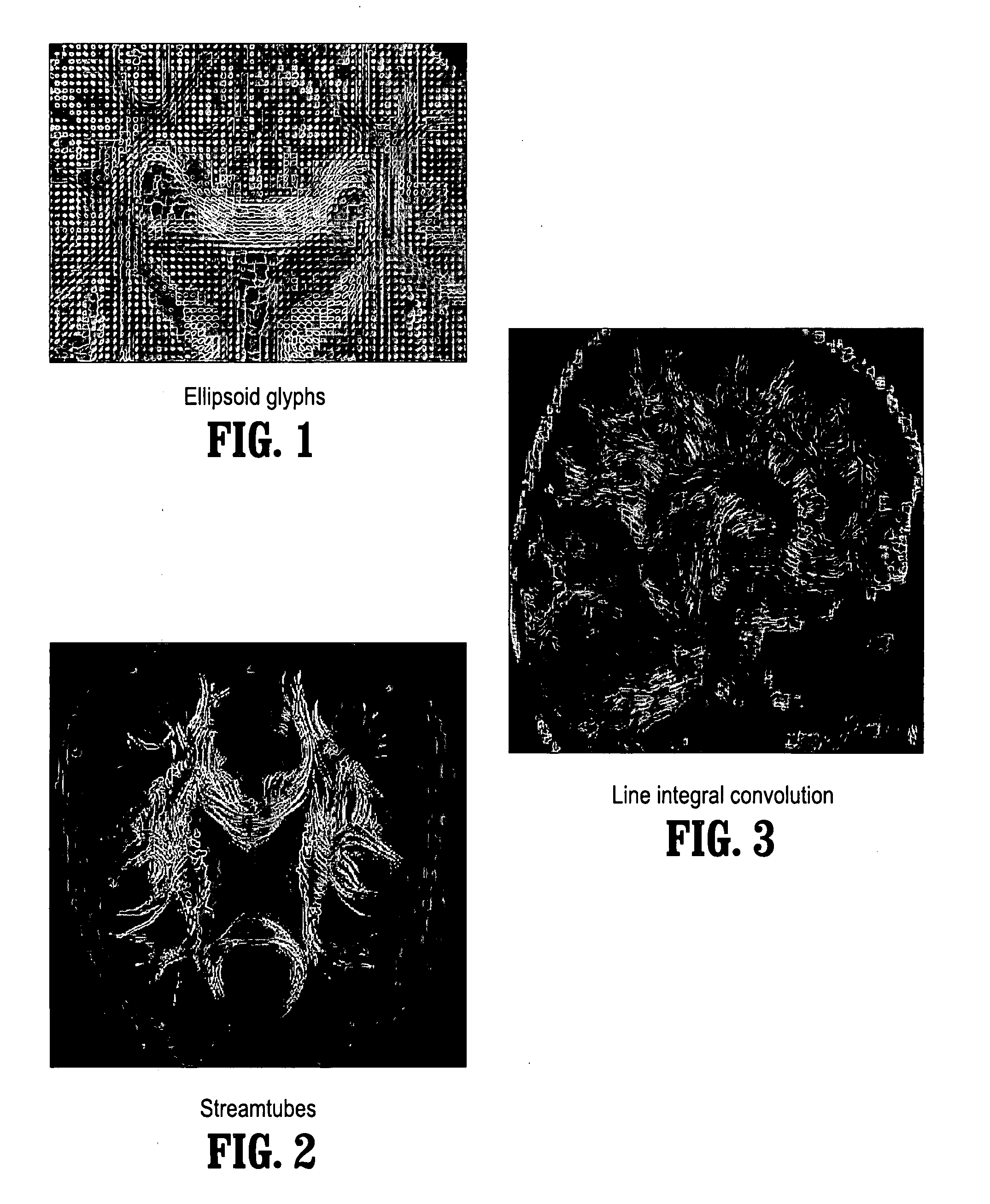 System and method for stochastic dt-mri connectivity mapping on the GPU