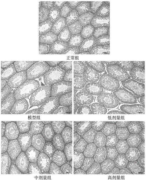 Application of traditional Chinese medicine composition on preparation of medicines or health care products for treating oligoasthenotspermia and infertility of men