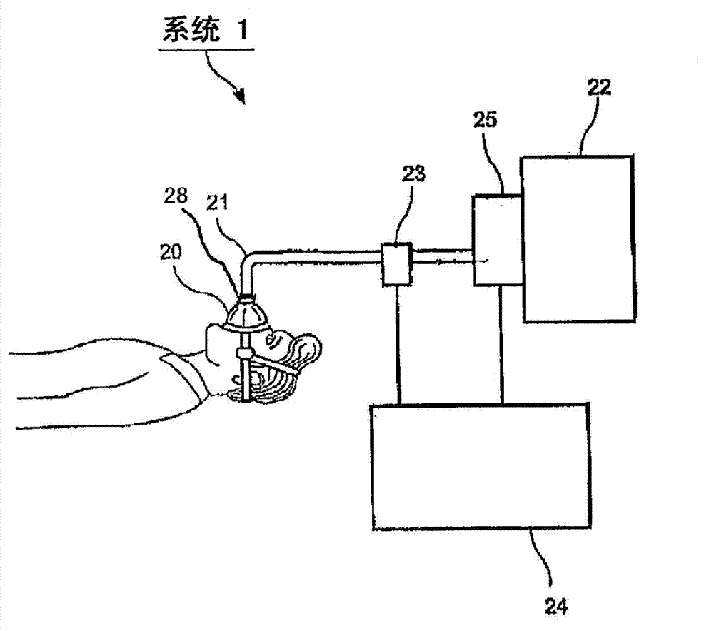 System And Method For Diagnosis And Treatment Of A Breathing Pattern Of A Patient