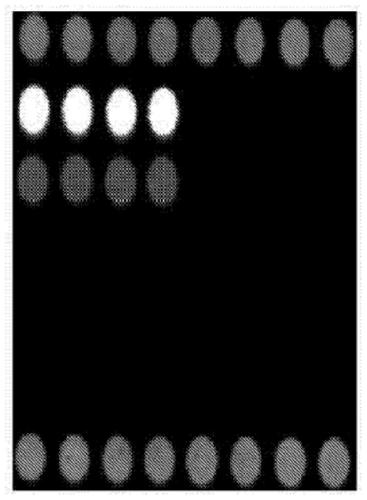 Gene chip for identifying seven fungal infection pathogens as well as kit and detection method thereof