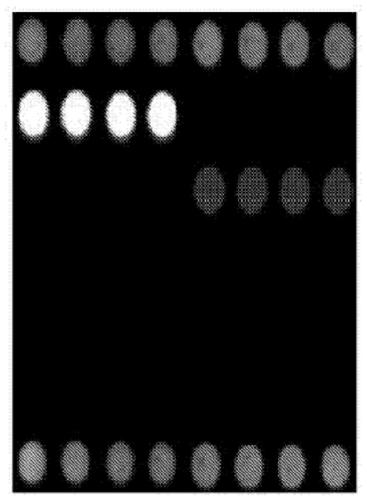 Gene chip for identifying seven fungal infection pathogens as well as kit and detection method thereof