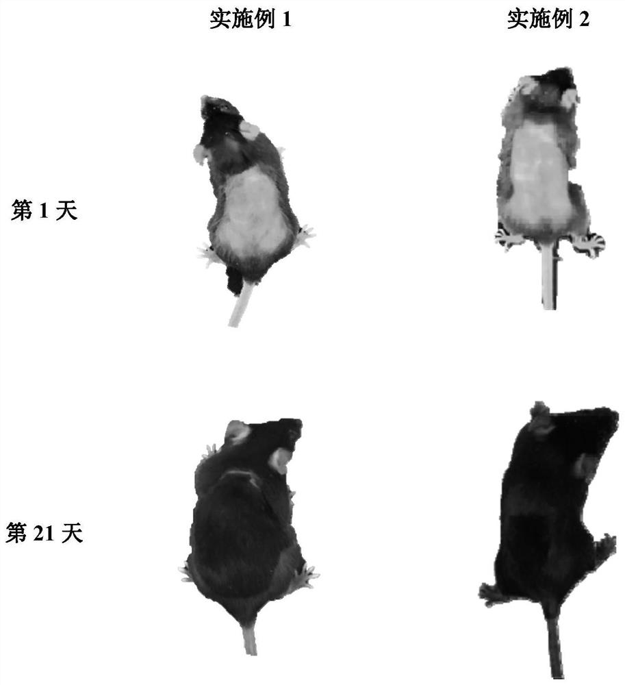 Traditional Chinese medicine composition for treating hair loss and its preparation method and application