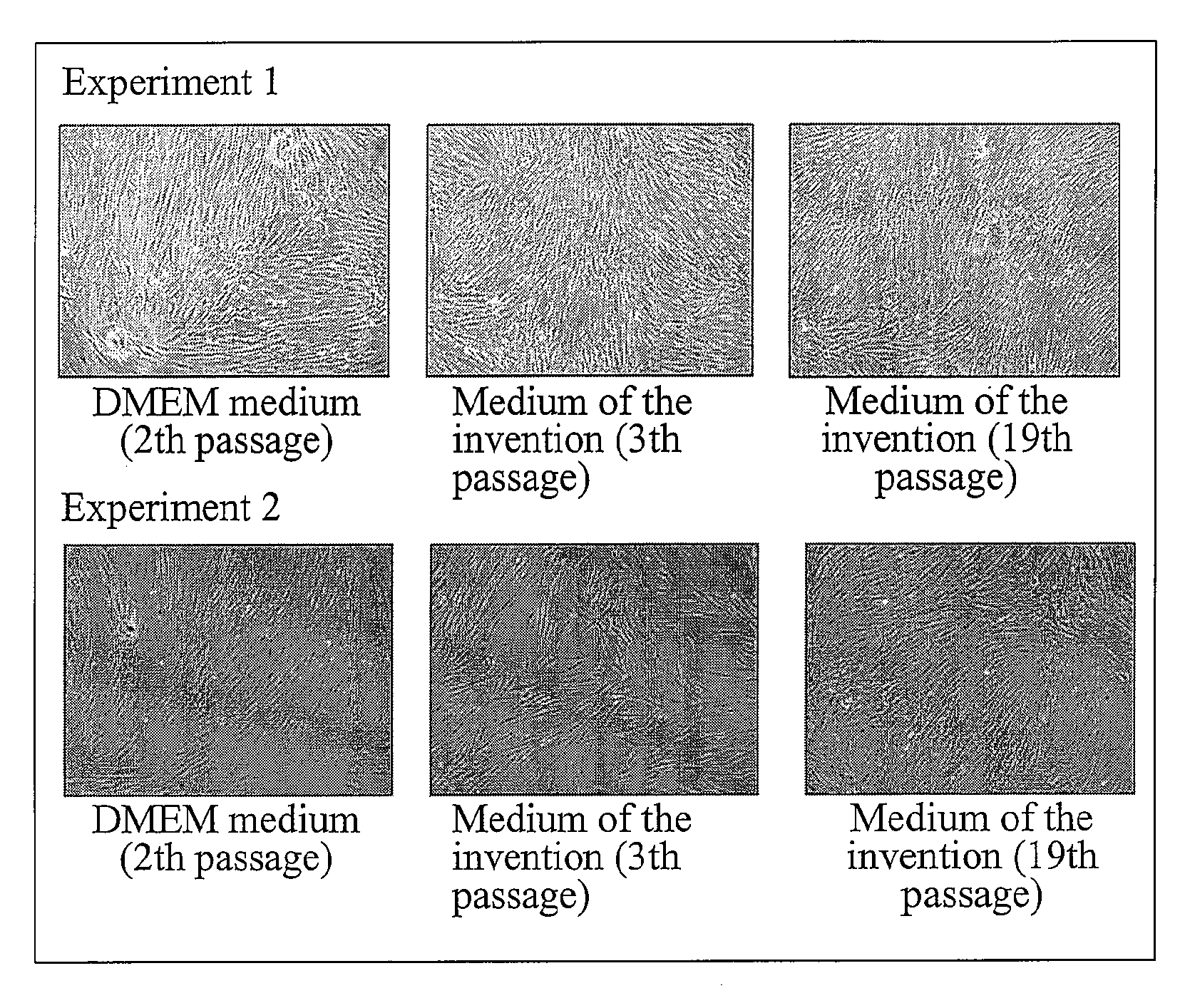 Stem cell medium