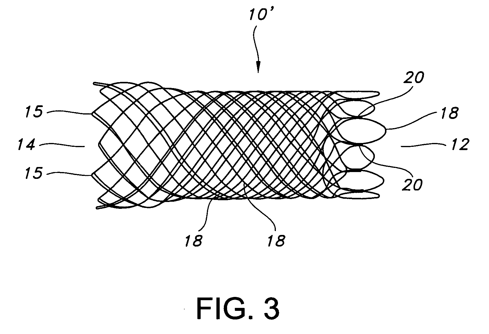 Atraumatic stent with reduced deployment force, method for making the same and method and apparatus for deploying and positioning the stent