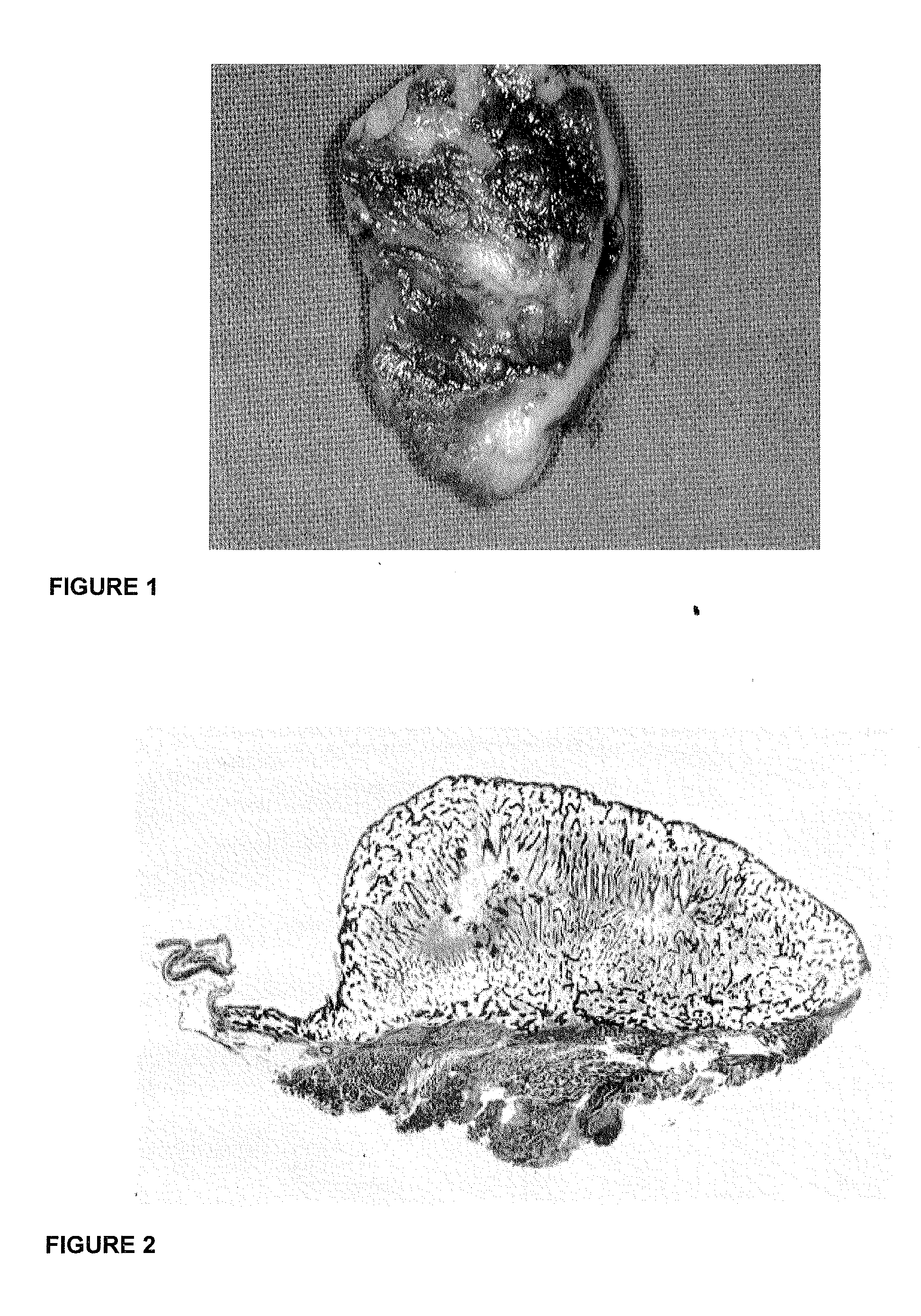 Osteogenic device for inducing bone formation in clinical contexts