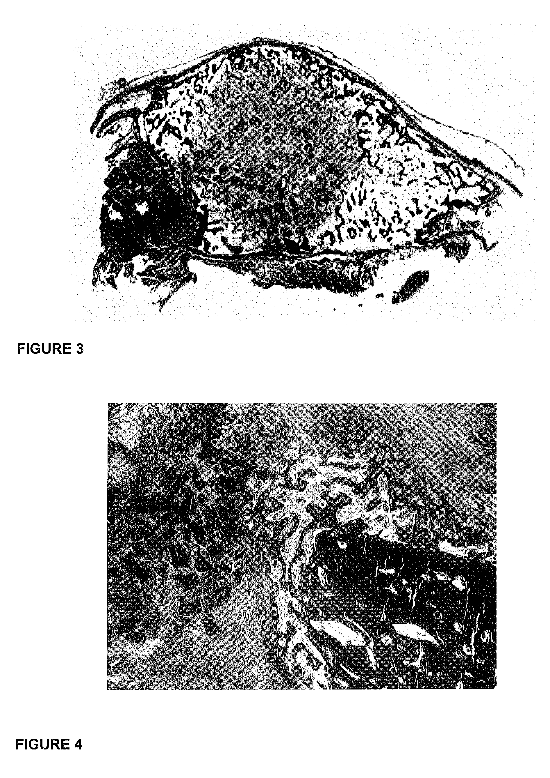 Osteogenic device for inducing bone formation in clinical contexts