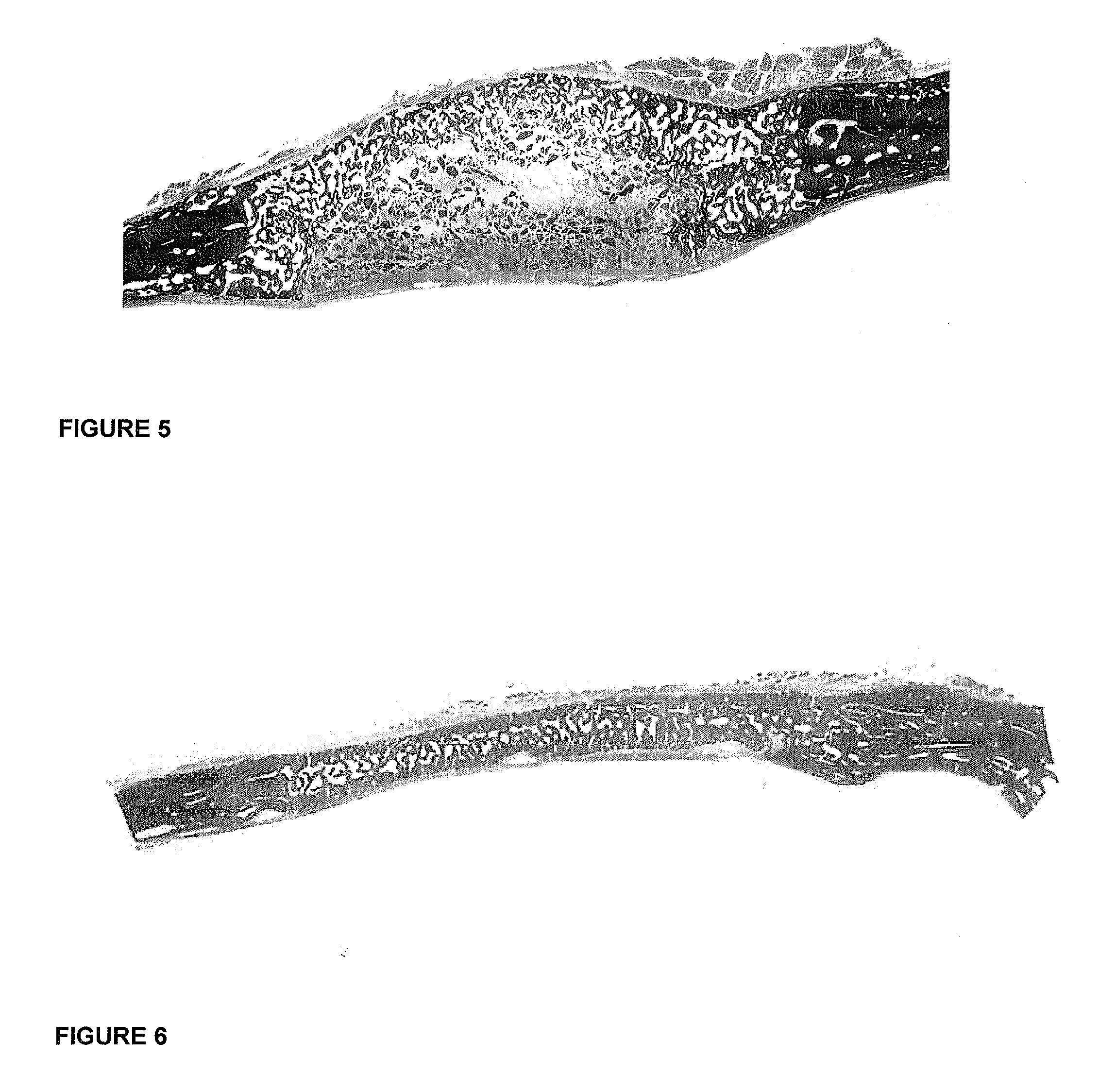 Osteogenic device for inducing bone formation in clinical contexts