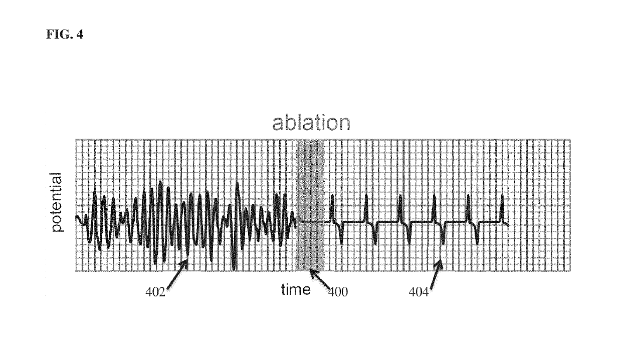 System and method for patient-specific image-based guidance of cardiac arrhythmia therapies