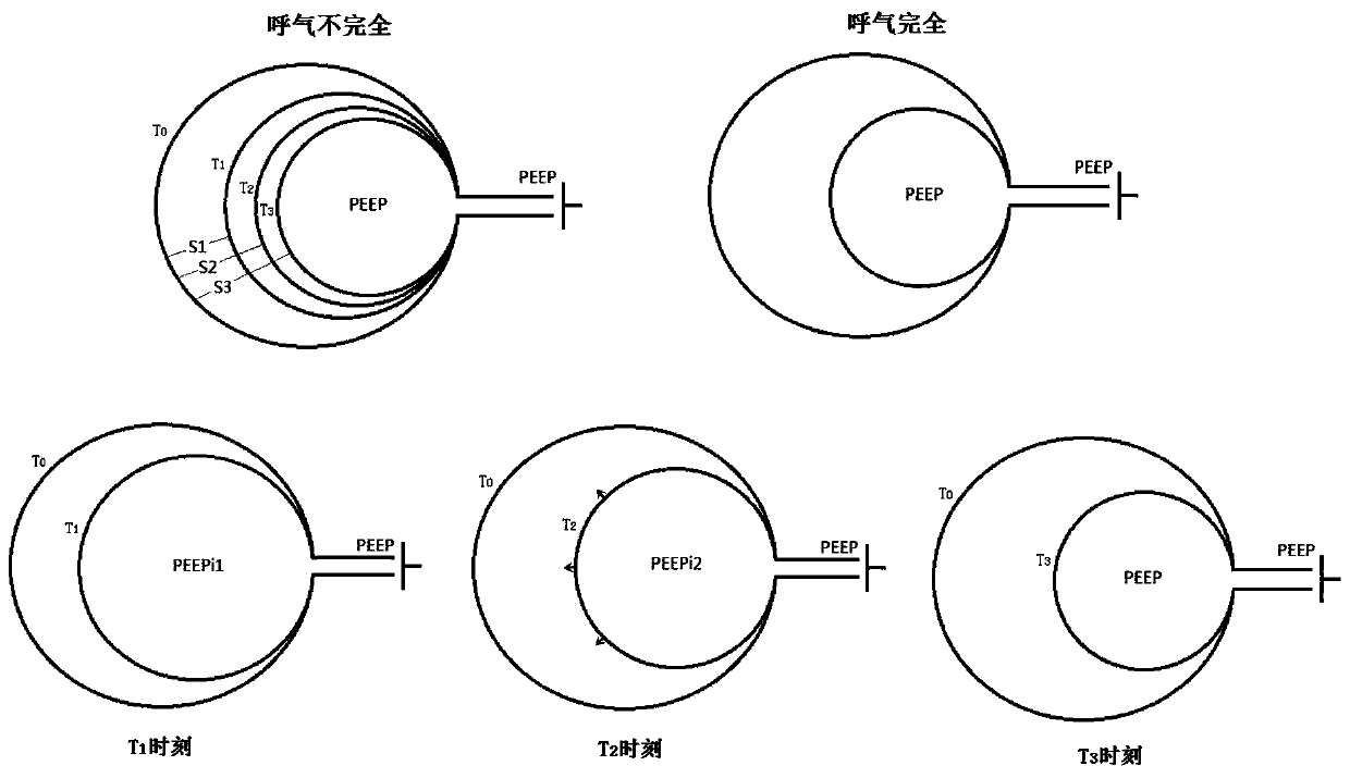 Method for estimating dynamic positive end-expiratory pressure in mechanical ventilation