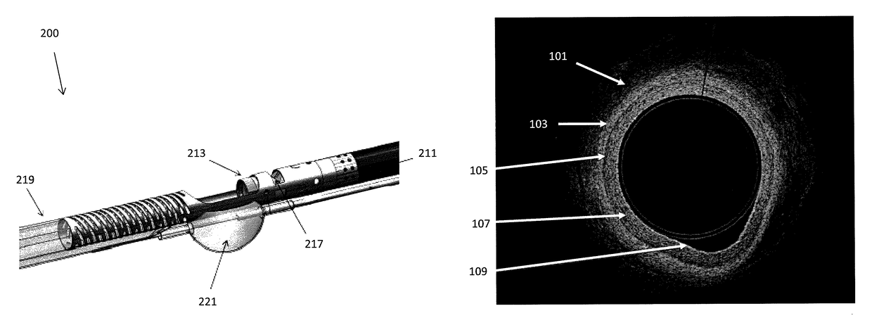 Identification of elastic lamina to guide interventional therapy