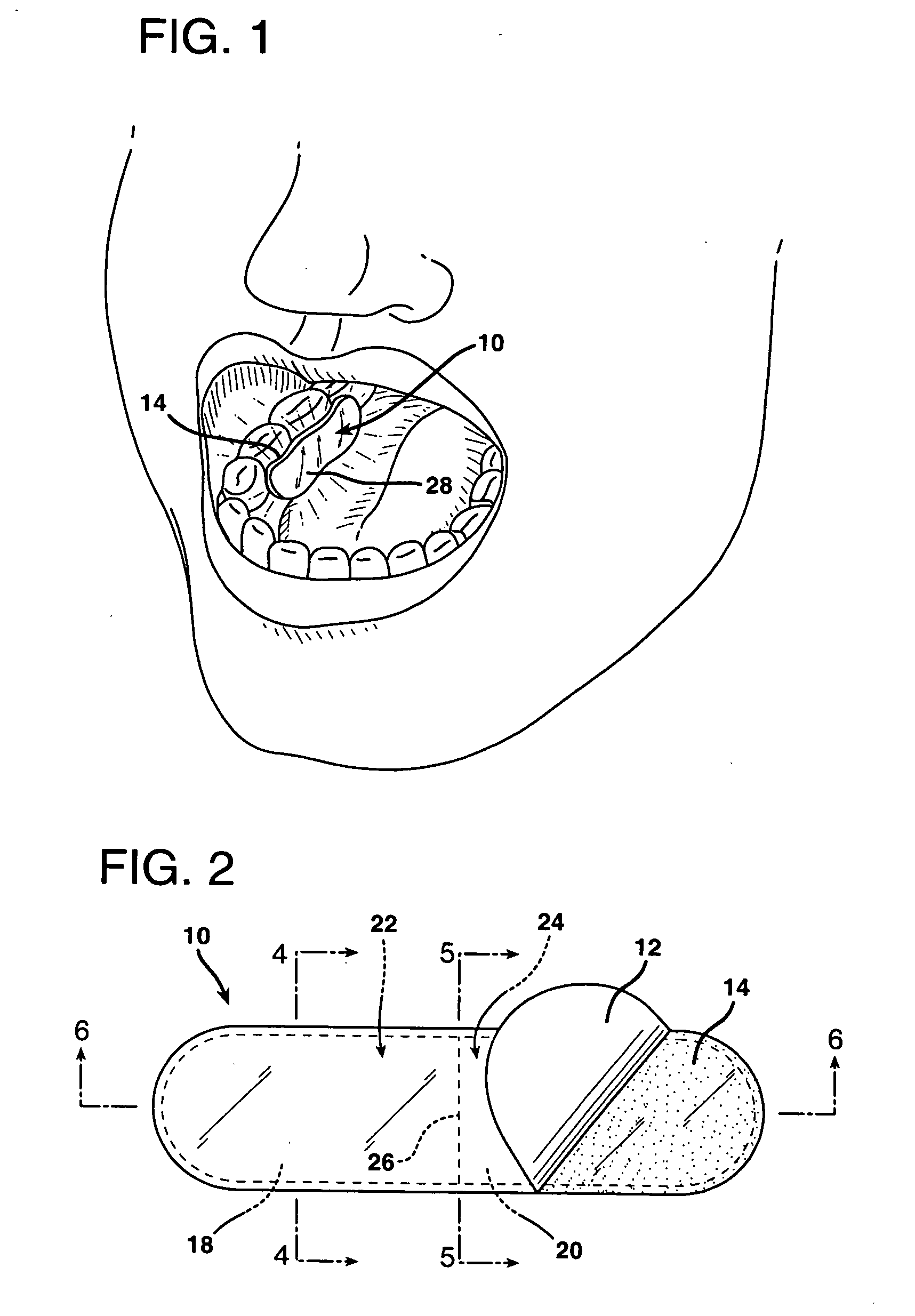 Intraoral illumination device