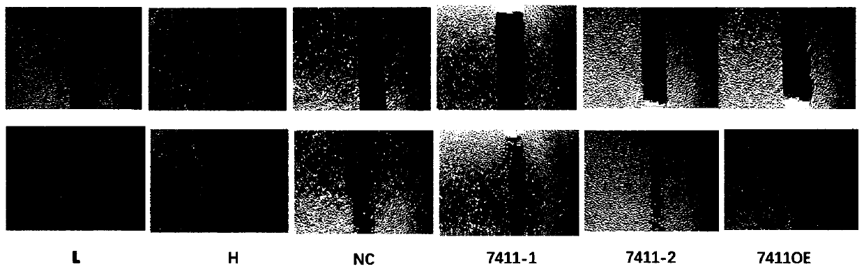 A kind of circRNA inhibits the application in the field of angiogenesis